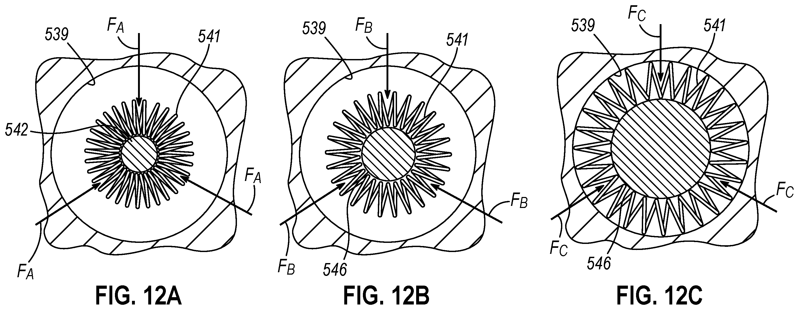 Patent US12564406 Figure 12 – Implantable sphincter assistance device with bimodal circumferential restriction force threshold