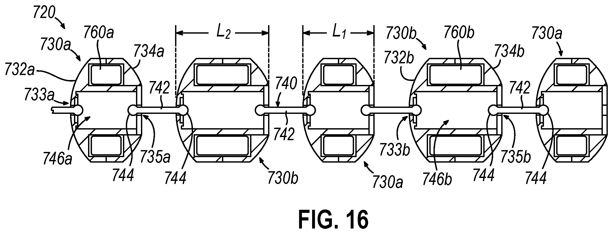 Patent US12564406 Figure 17 – Implantable sphincter assistance device with bimodal circumferential restriction force threshold