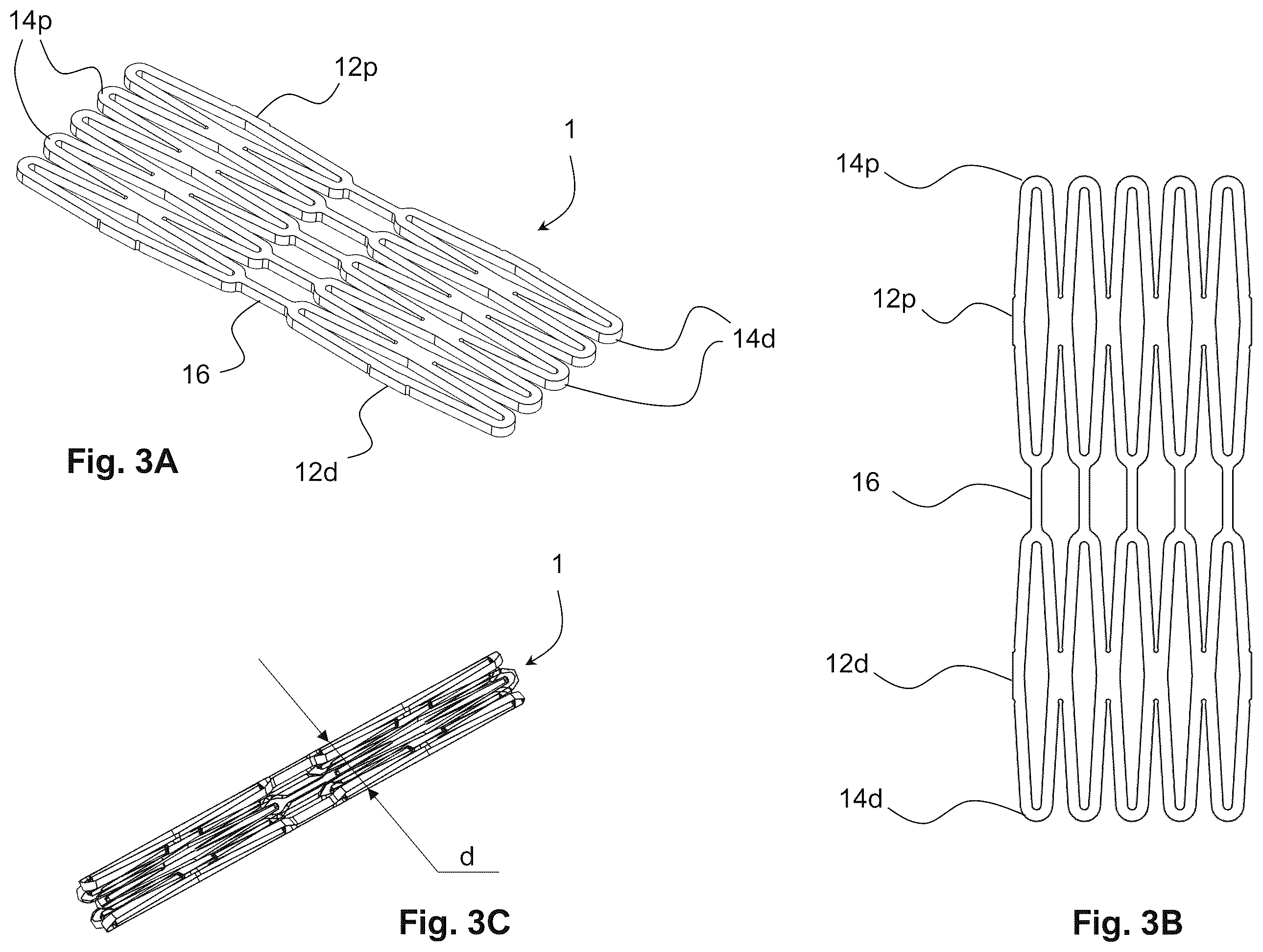 Patent US12564407 Figure 3 – Reversible occlusion device, system and method