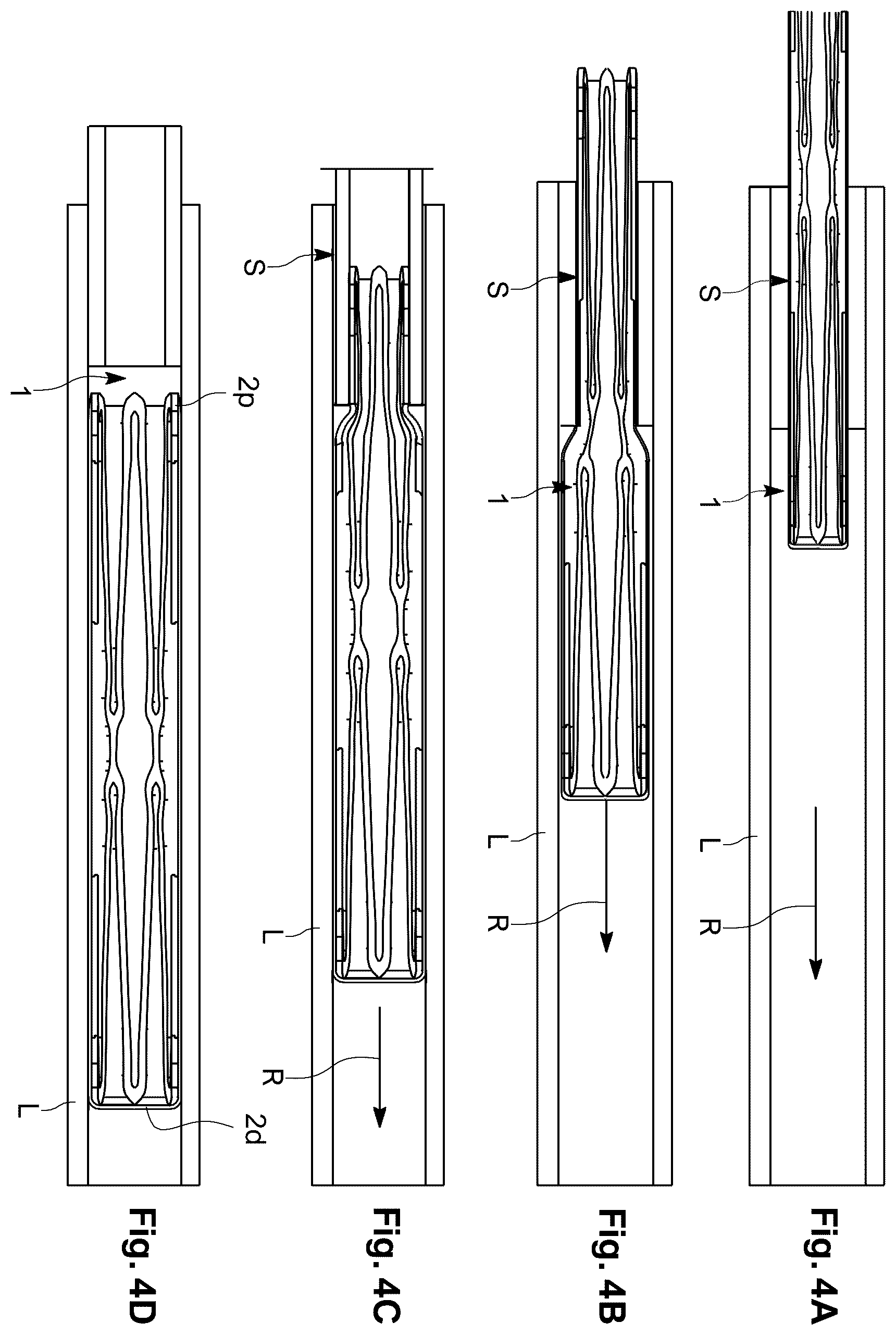 Patent US12564407 Figure 4 – Reversible occlusion device, system and method
