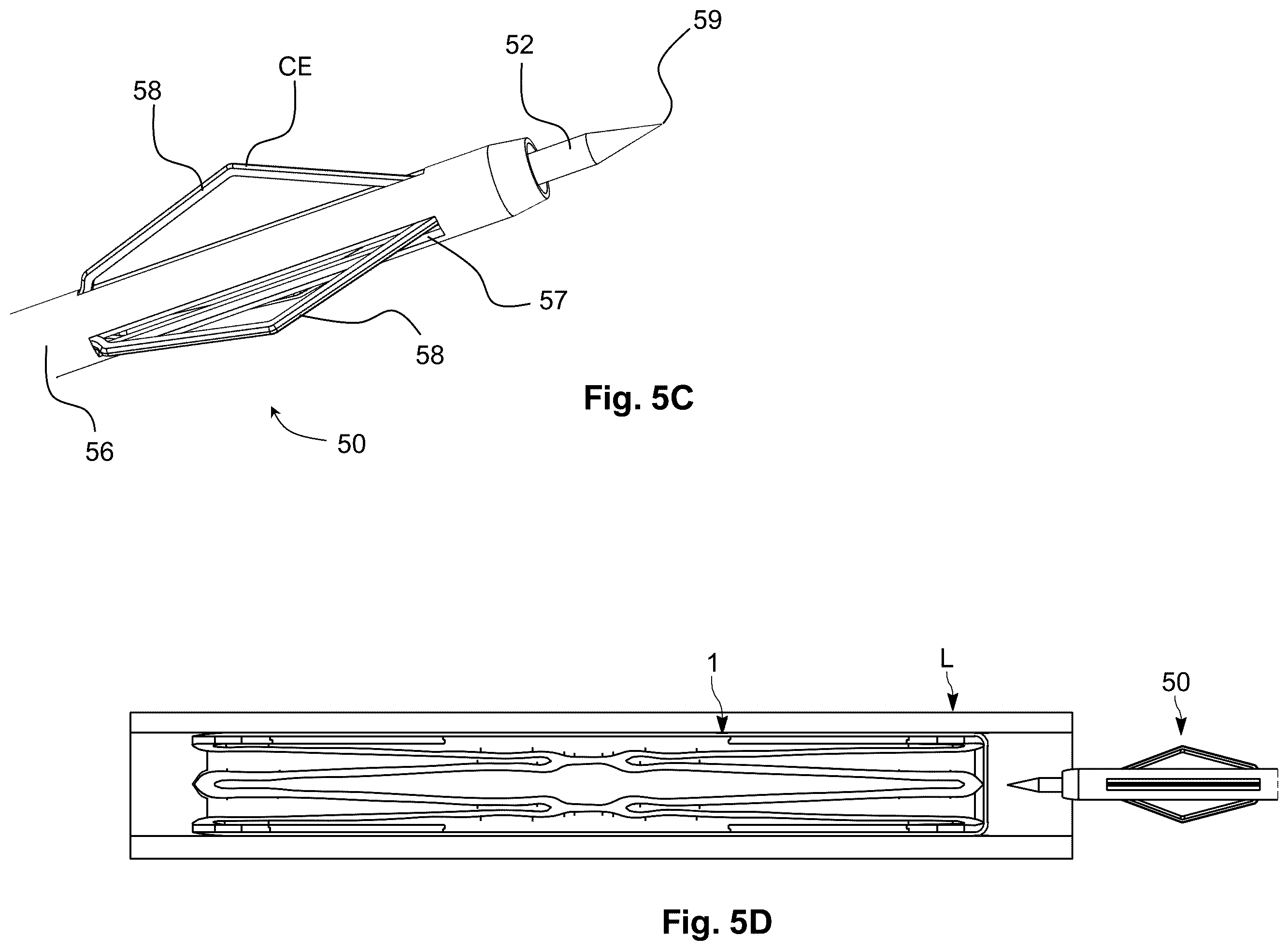 Patent US12564407 Figure 6 – Reversible occlusion device, system and method