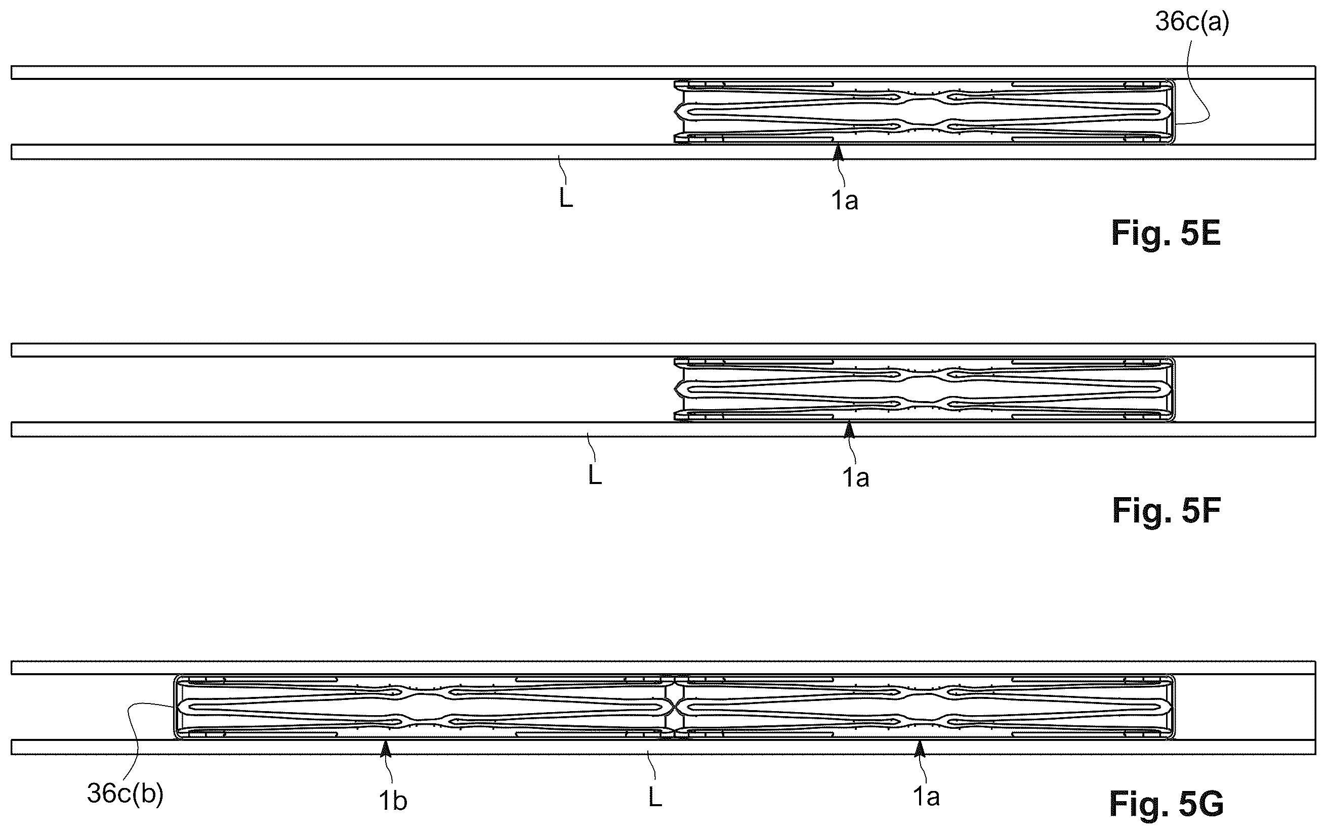 Patent US12564407 Figure 7 – Reversible occlusion device, system and method