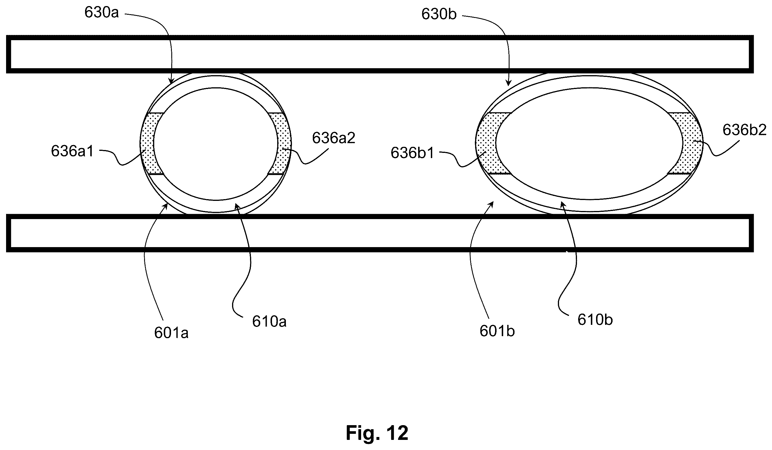 Patent US12564407 Figure 14 – Reversible occlusion device, system and method