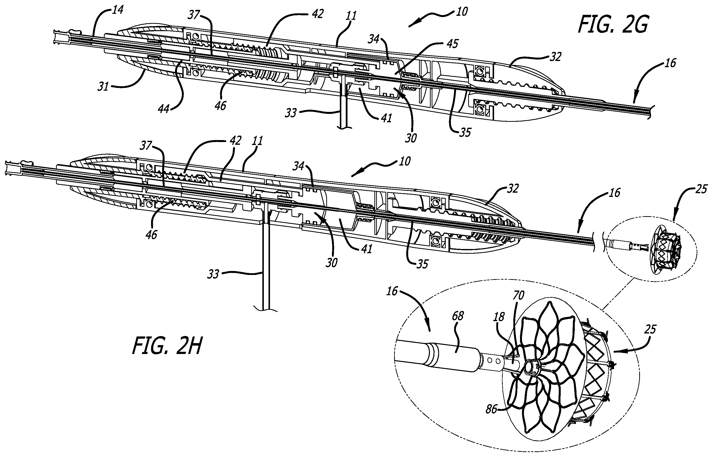 Patent US12564408 Figure 5 – Medical occluder delivery systems