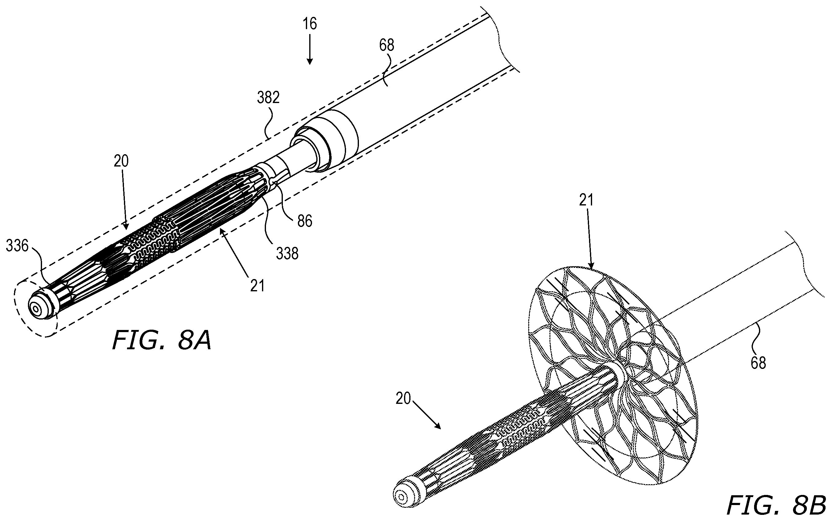 Patent US12564408 Figure 14 – Medical occluder delivery systems
