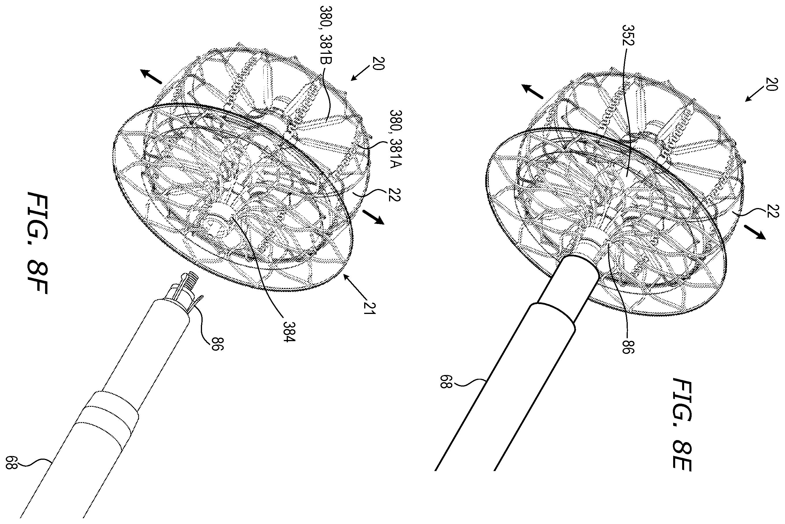 Patent US12564408 Figure 16 – Medical occluder delivery systems
