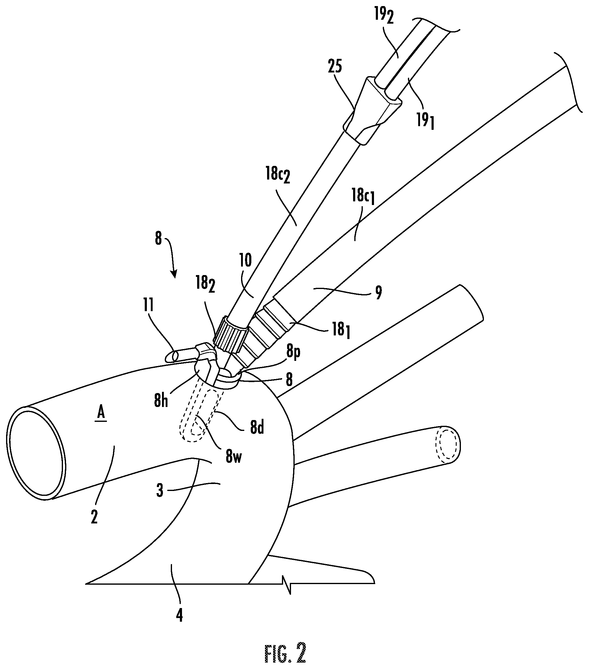 Patent US12564409 Figure 2 – Double lumen aortic cannula and cross clamp assembly and related methods