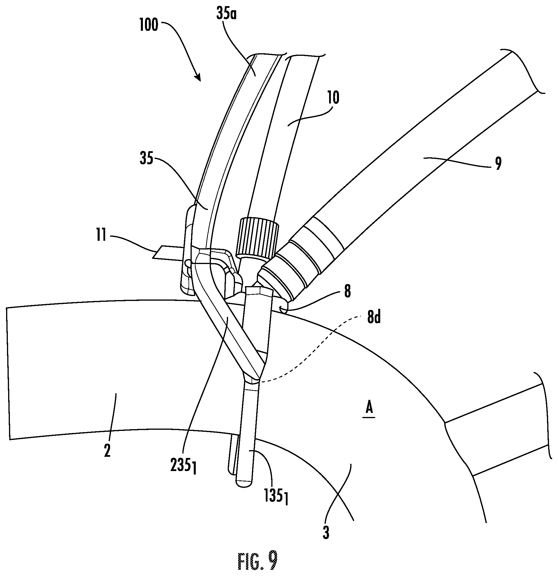 Patent US12564409 Figure 9 – Double lumen aortic cannula and cross clamp assembly and related methods