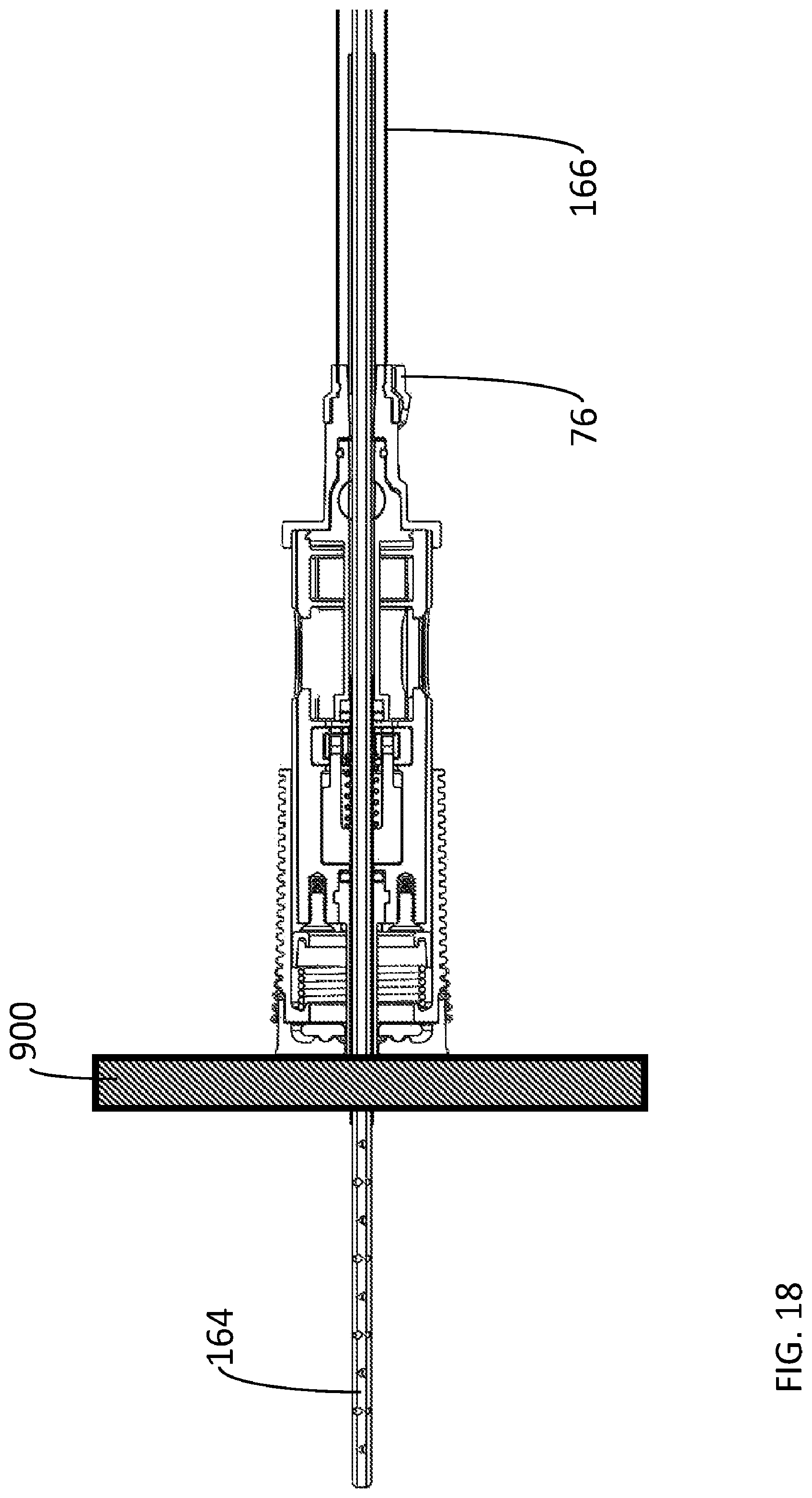 Patent US12564412 Figure 19 – Percutaneous access pathway system