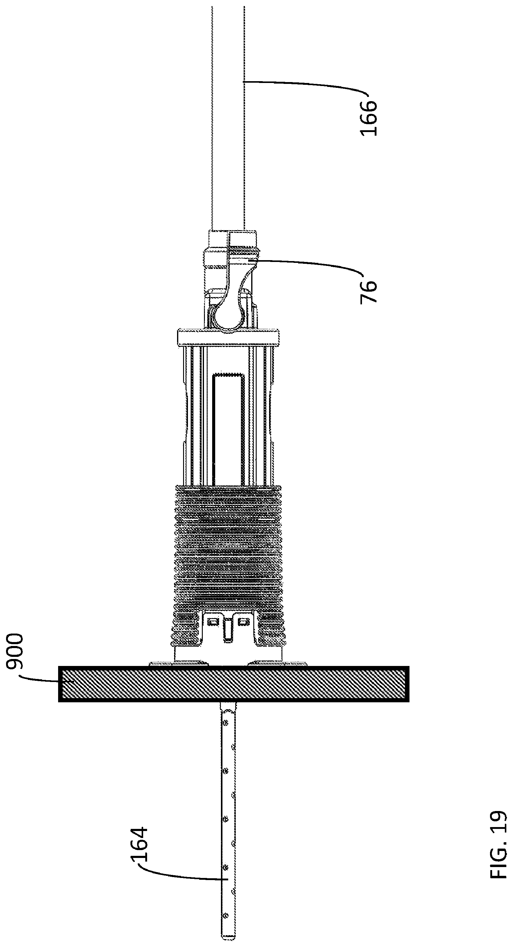 Patent US12564412 Figure 20 – Percutaneous access pathway system