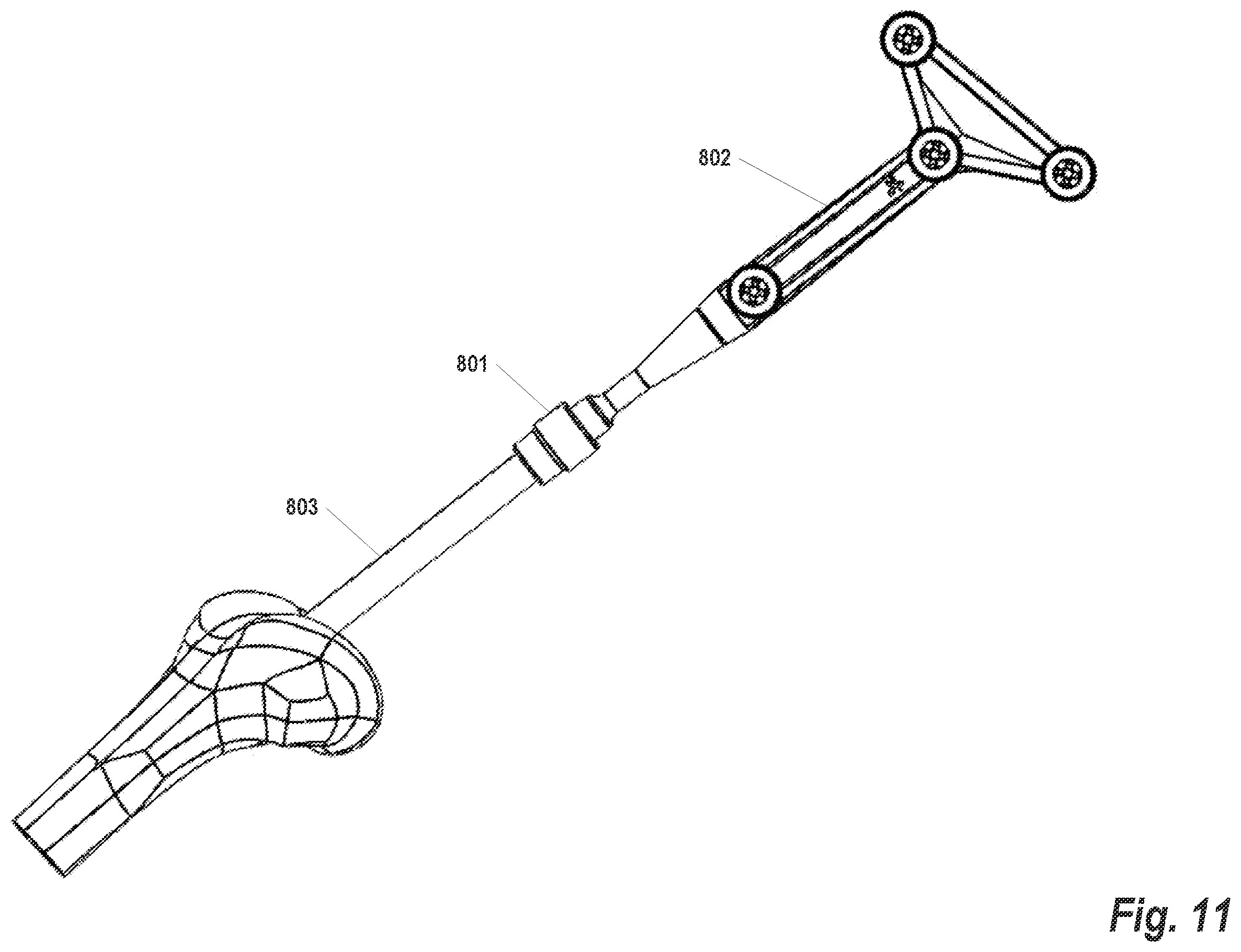 Patent US12564413 Figure 17 – Registration of intramedullary canal during revision total knee arthroplasty