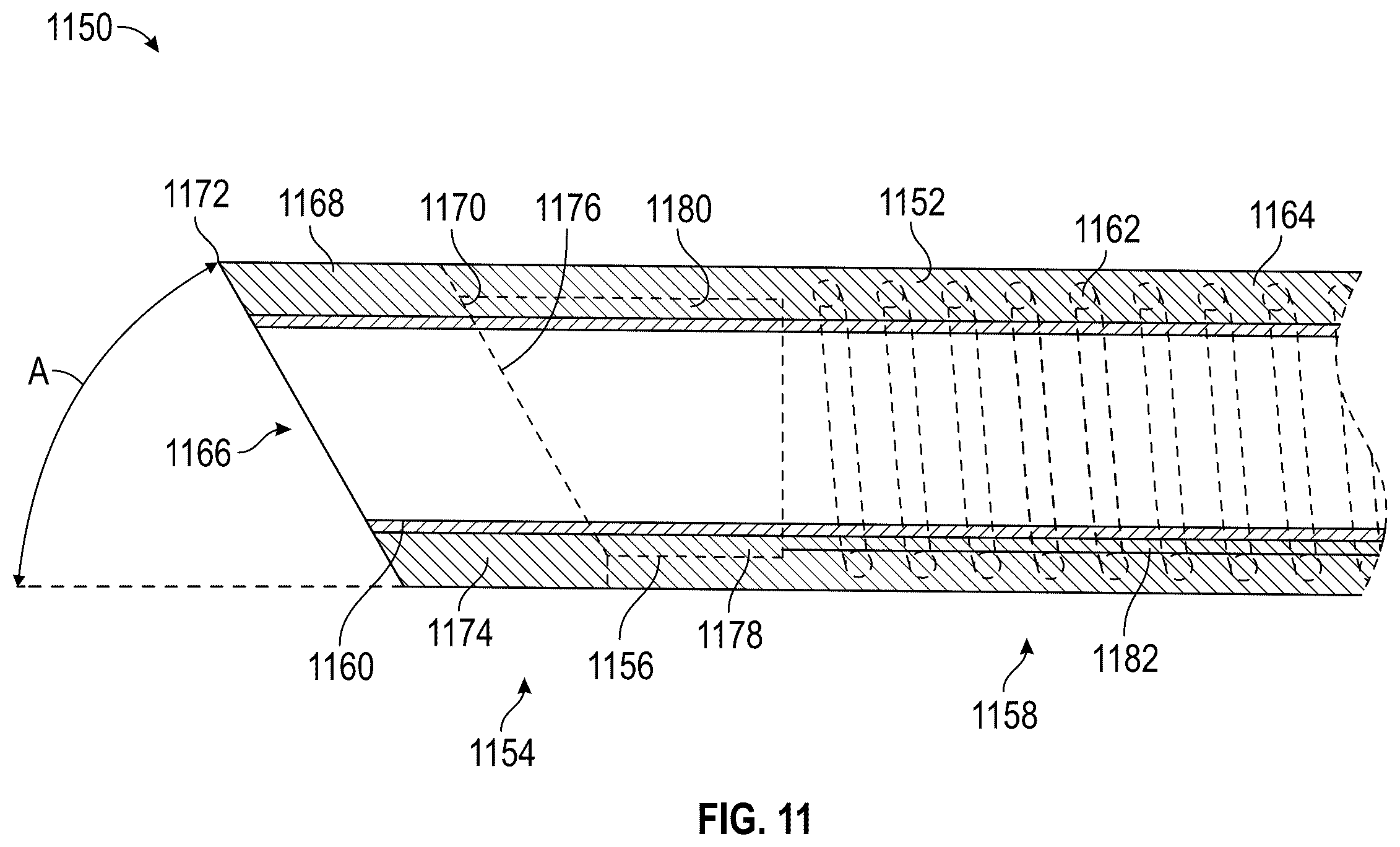 Patent US12564414 Figure 12 – Method of supra-aortic access for a neurovascular procedure