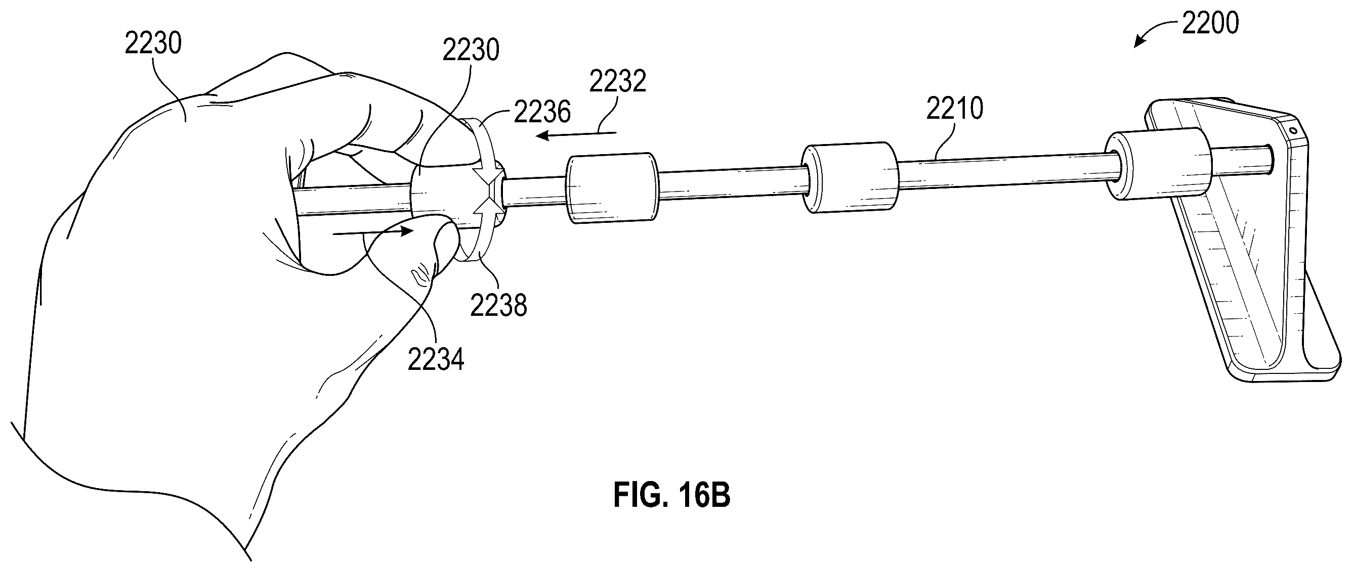 Patent US12564414 Figure 17 – Method of supra-aortic access for a neurovascular procedure