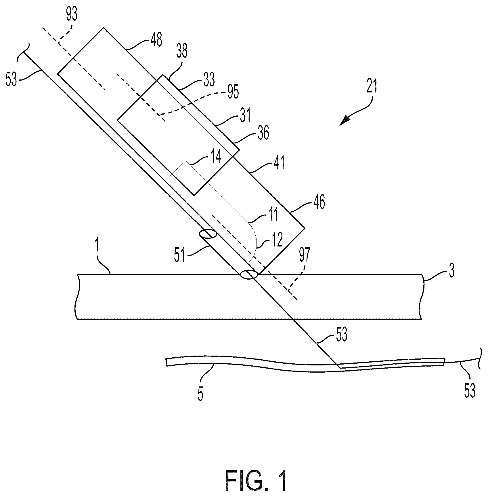Patent US12564419 Figure 1 – Surgical incision apparatus and related methods thereof