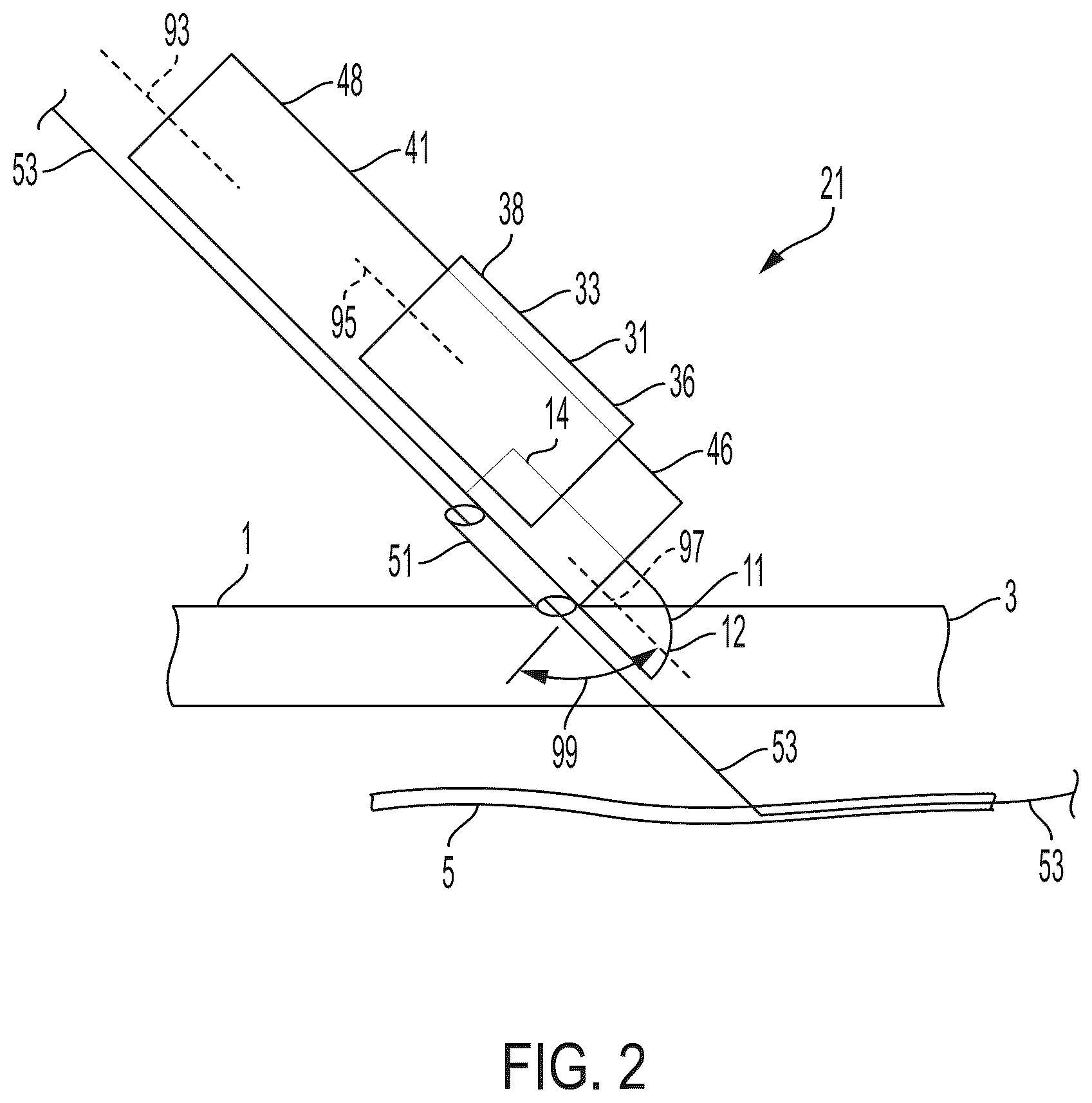 Patent US12564419 Figure 2 – Surgical incision apparatus and related methods thereof