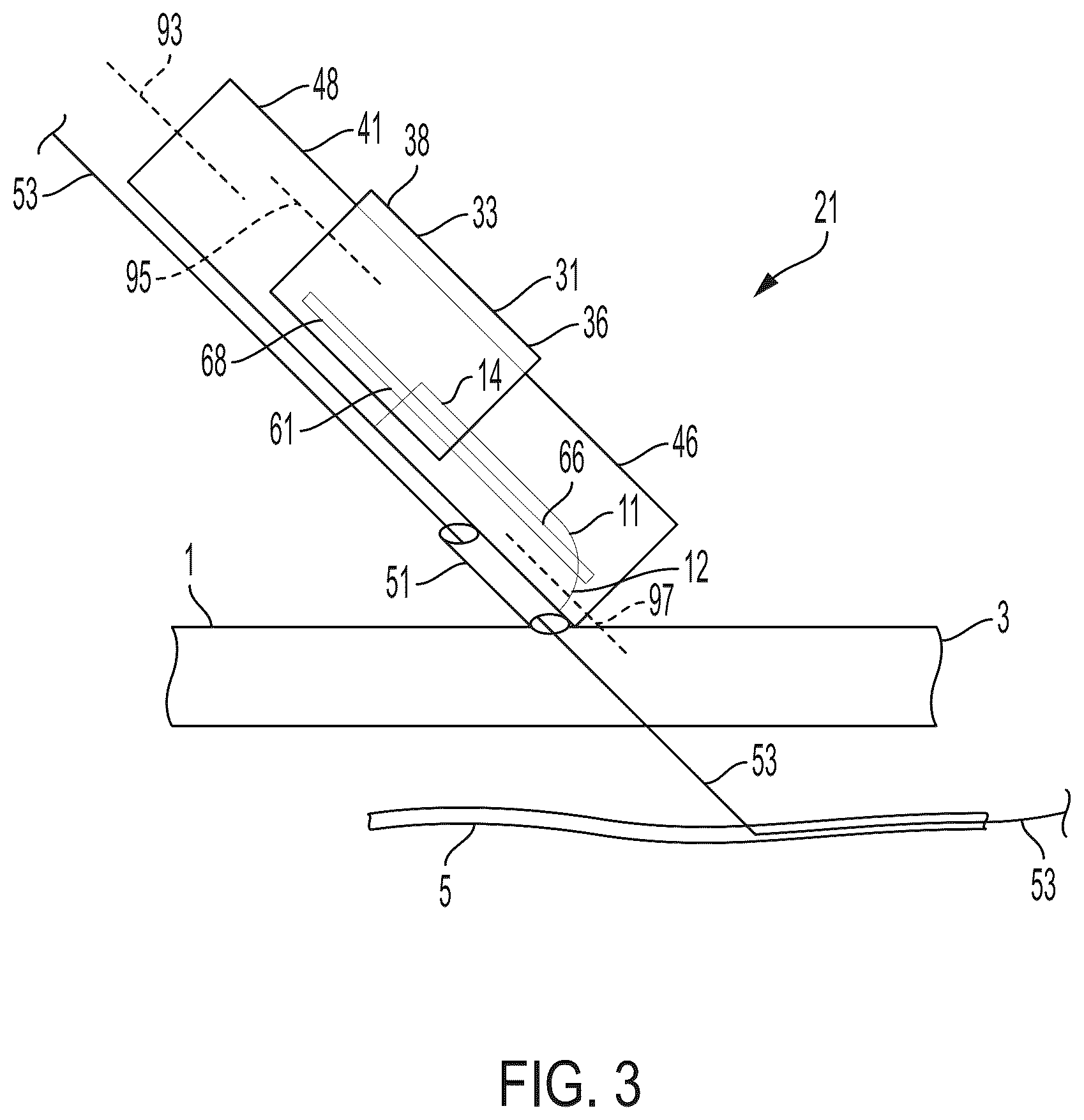 Patent US12564419 Figure 3 – Surgical incision apparatus and related methods thereof