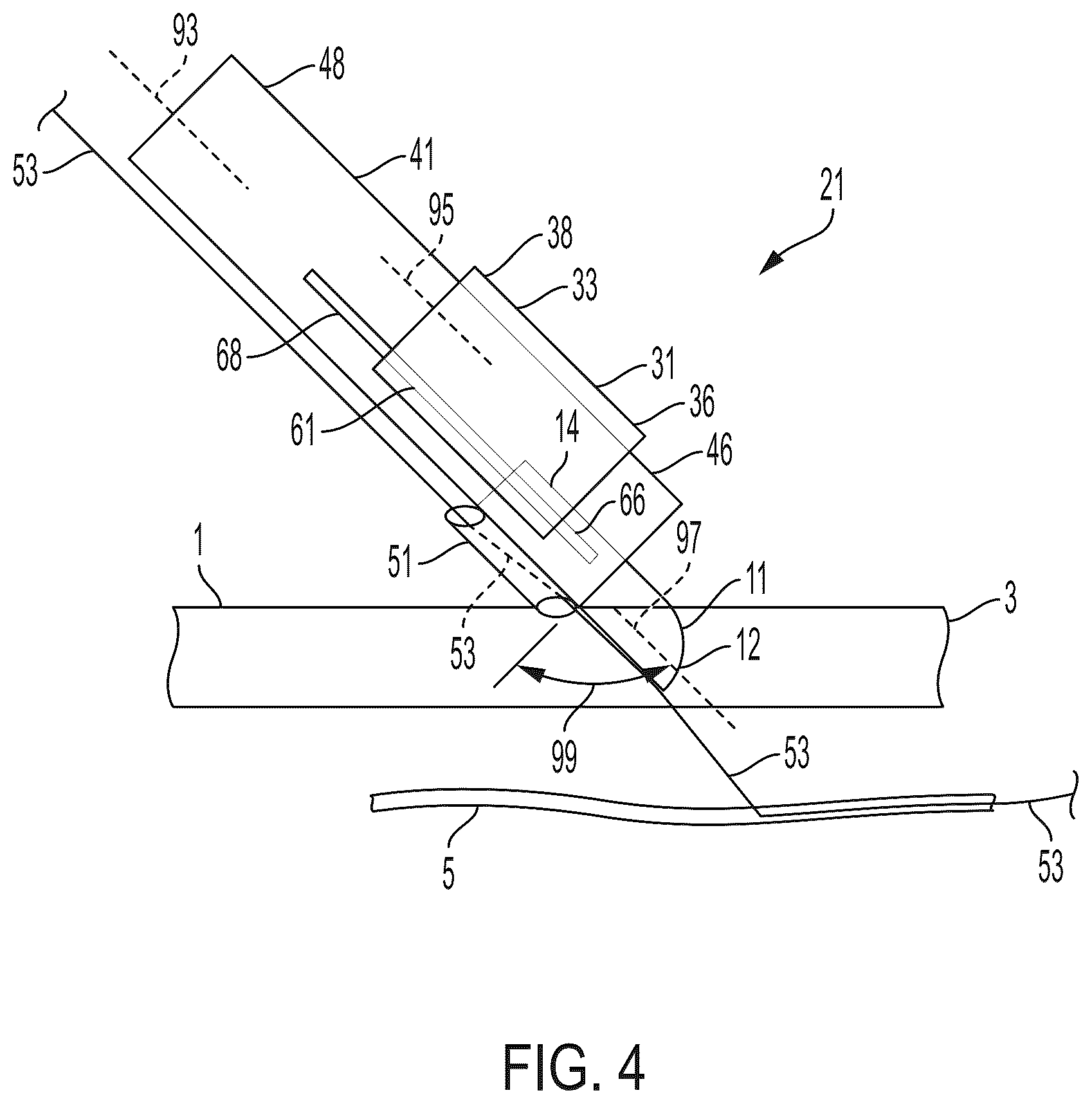 Patent US12564419 Figure 4 – Surgical incision apparatus and related methods thereof