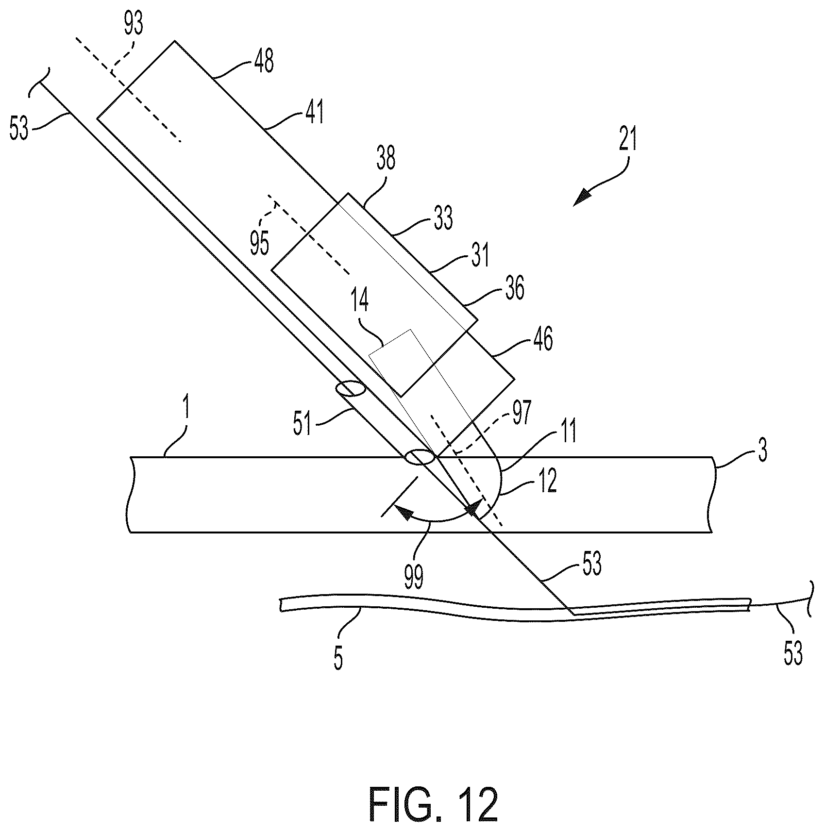 Patent US12564419 Figure 13 – Surgical incision apparatus and related methods thereof