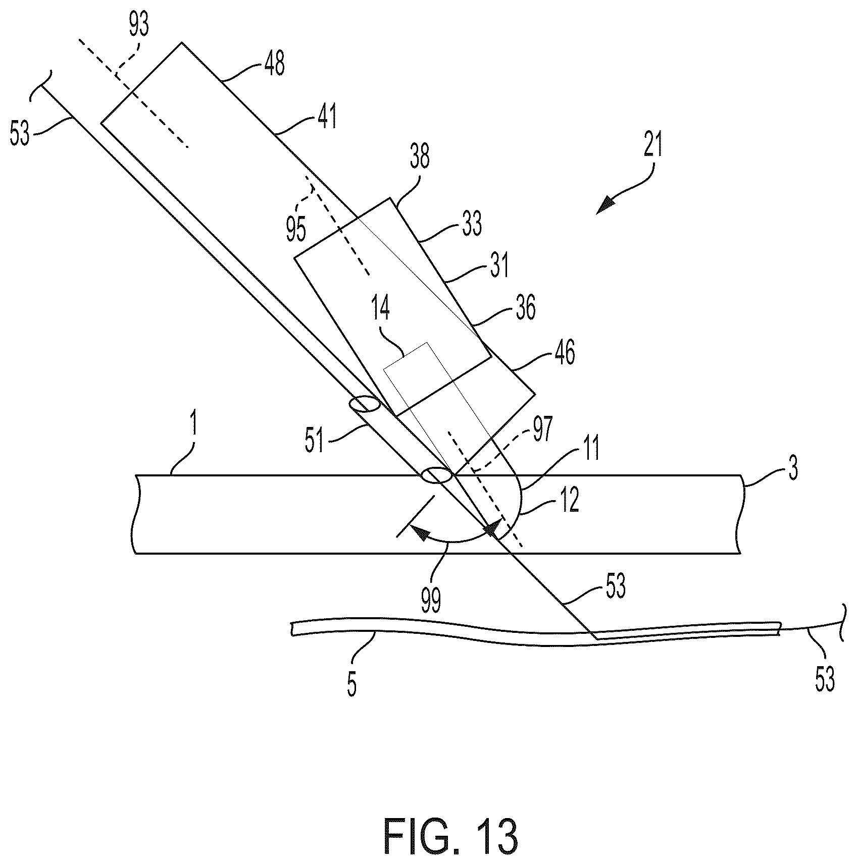 Patent US12564419 Figure 14 – Surgical incision apparatus and related methods thereof