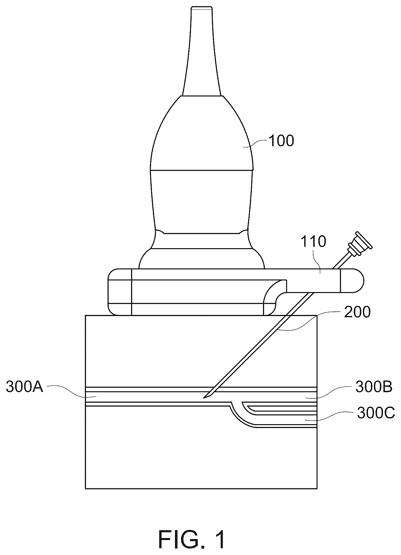 Patent US12564420 Figure 1 – Needle guidance system