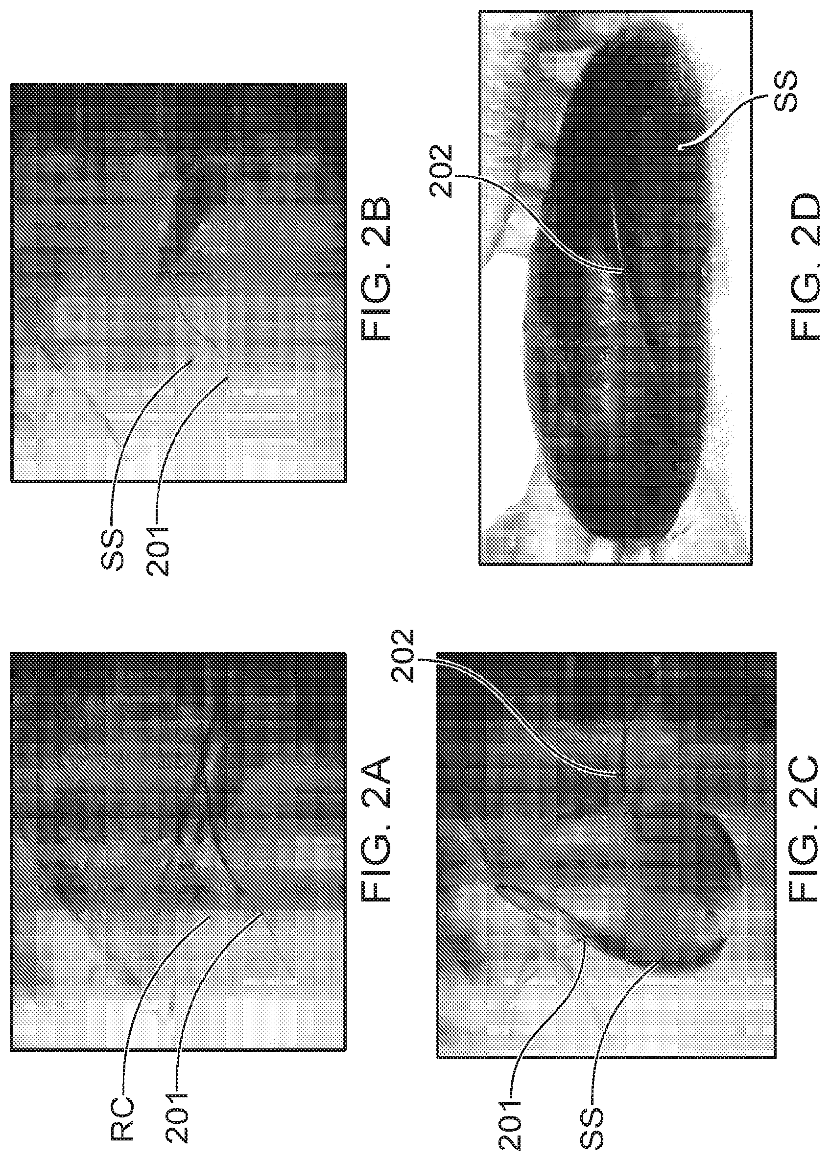 Patent US12564423 Figure 2 – Systems and methods for accessing a renal capsule for diagnostic and therapeutic purposes