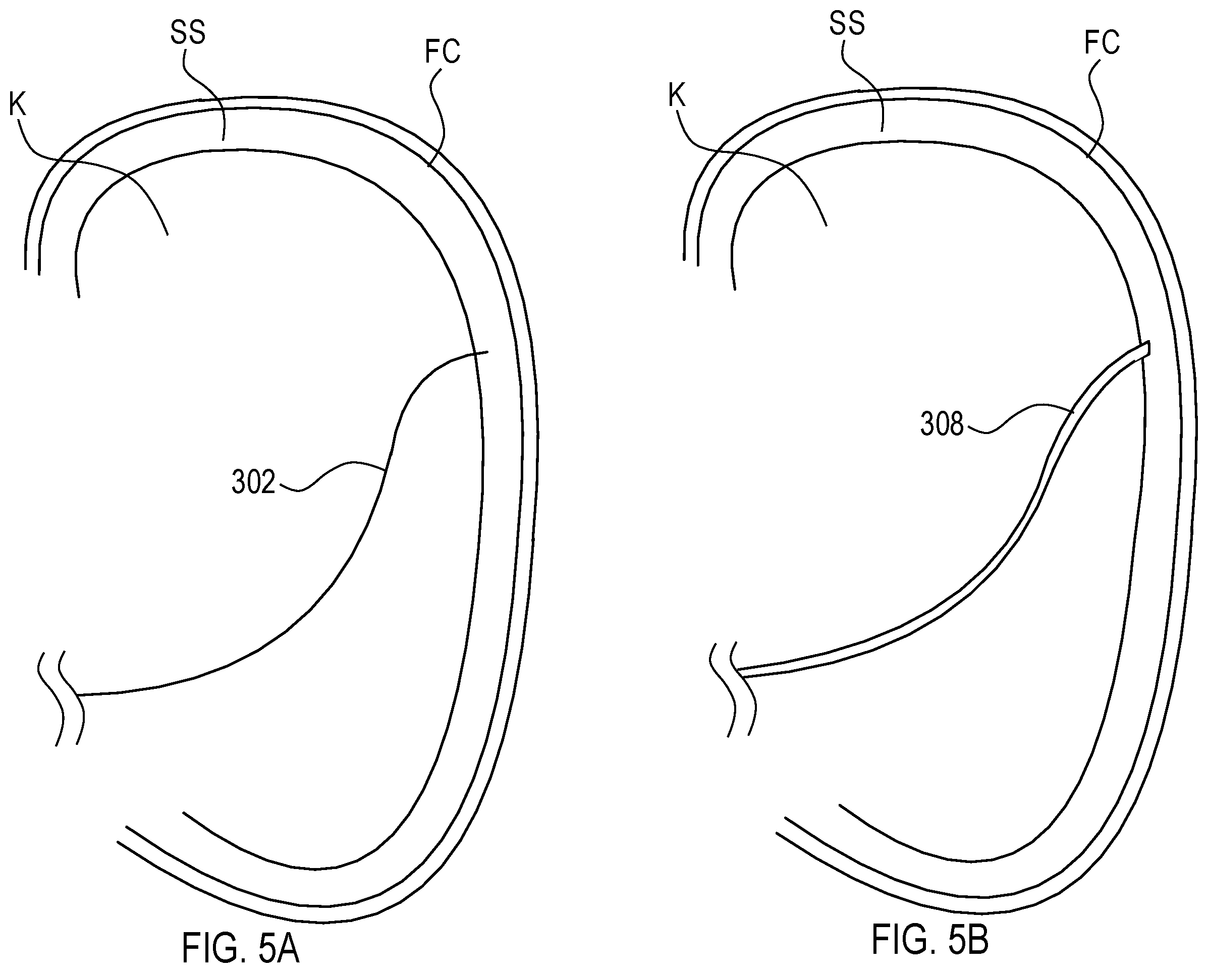 Patent US12564423 Figure 7 – Systems and methods for accessing a renal capsule for diagnostic and therapeutic purposes