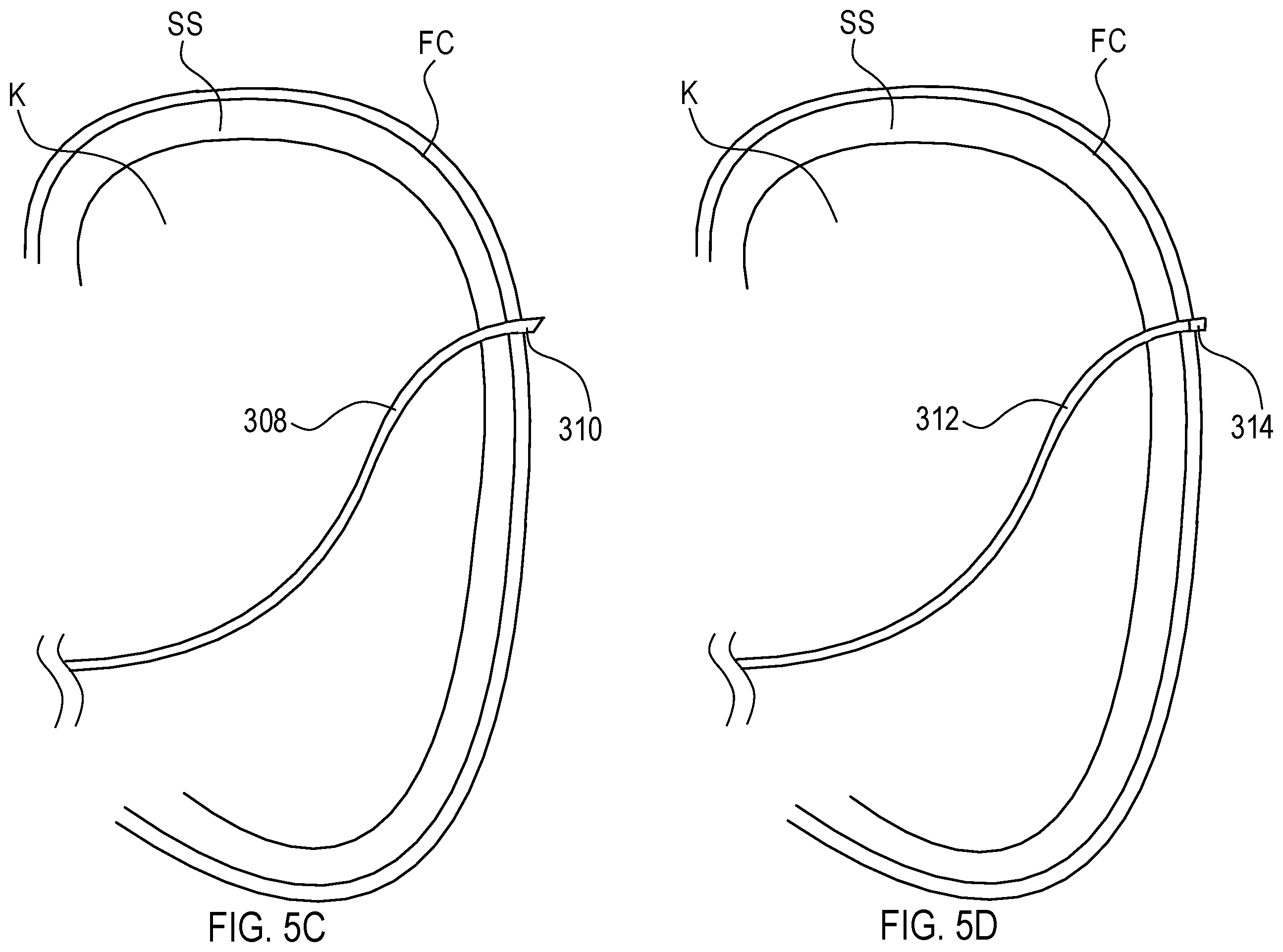 Patent US12564423 Figure 8 – Systems and methods for accessing a renal capsule for diagnostic and therapeutic purposes