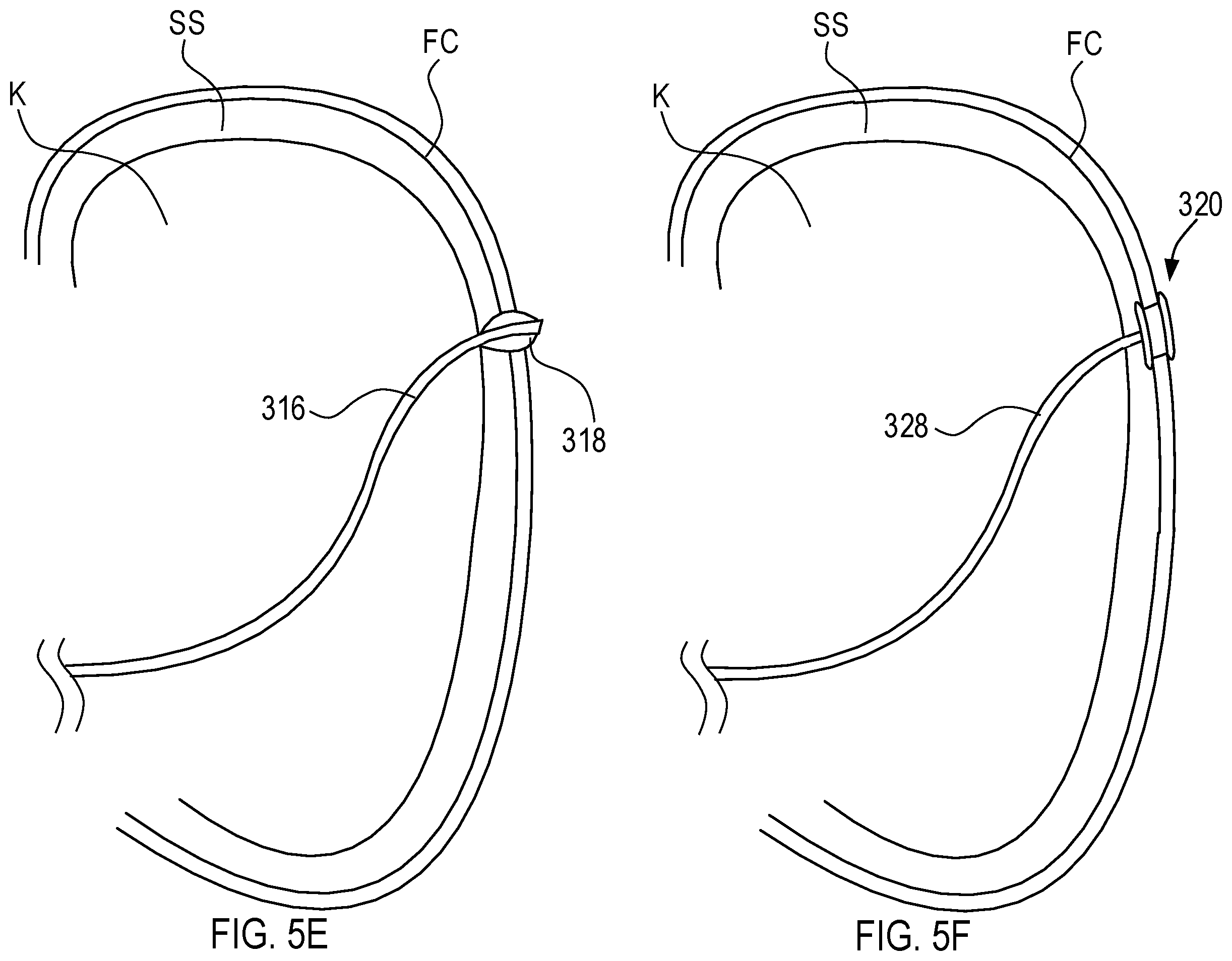 Patent US12564423 Figure 9 – Systems and methods for accessing a renal capsule for diagnostic and therapeutic purposes