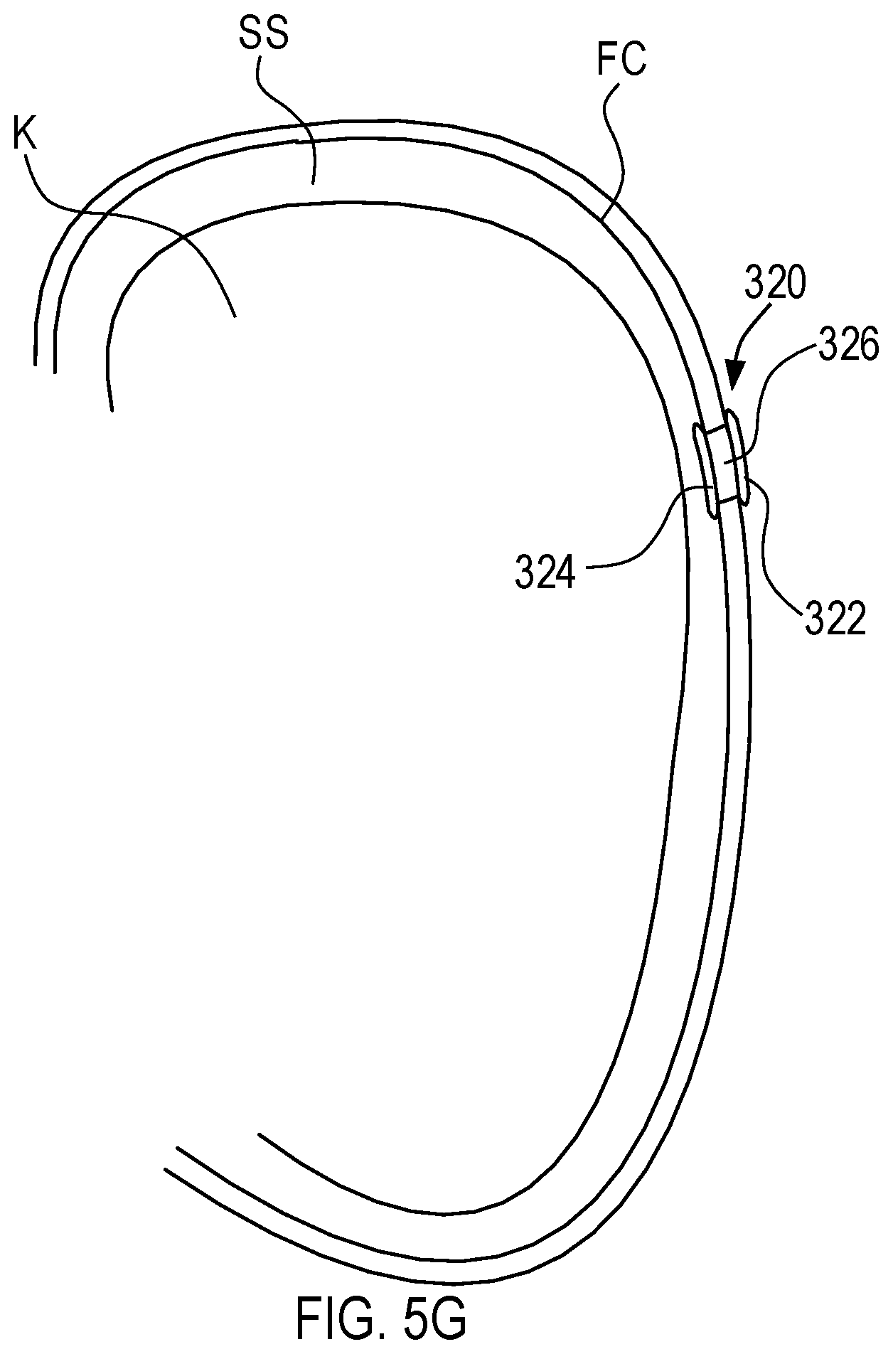 Patent US12564423 Figure 10 – Systems and methods for accessing a renal capsule for diagnostic and therapeutic purposes