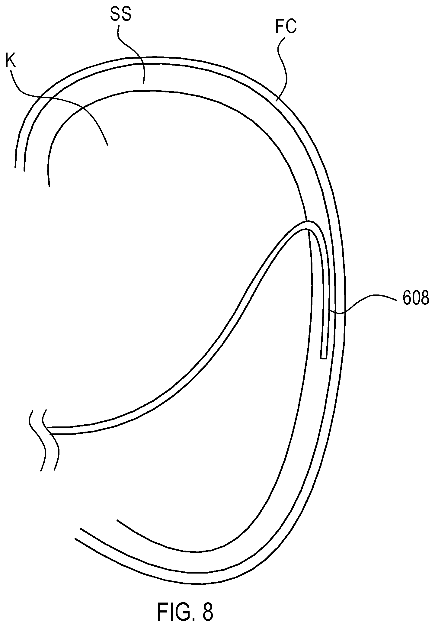 Patent US12564423 Figure 14 – Systems and methods for accessing a renal capsule for diagnostic and therapeutic purposes