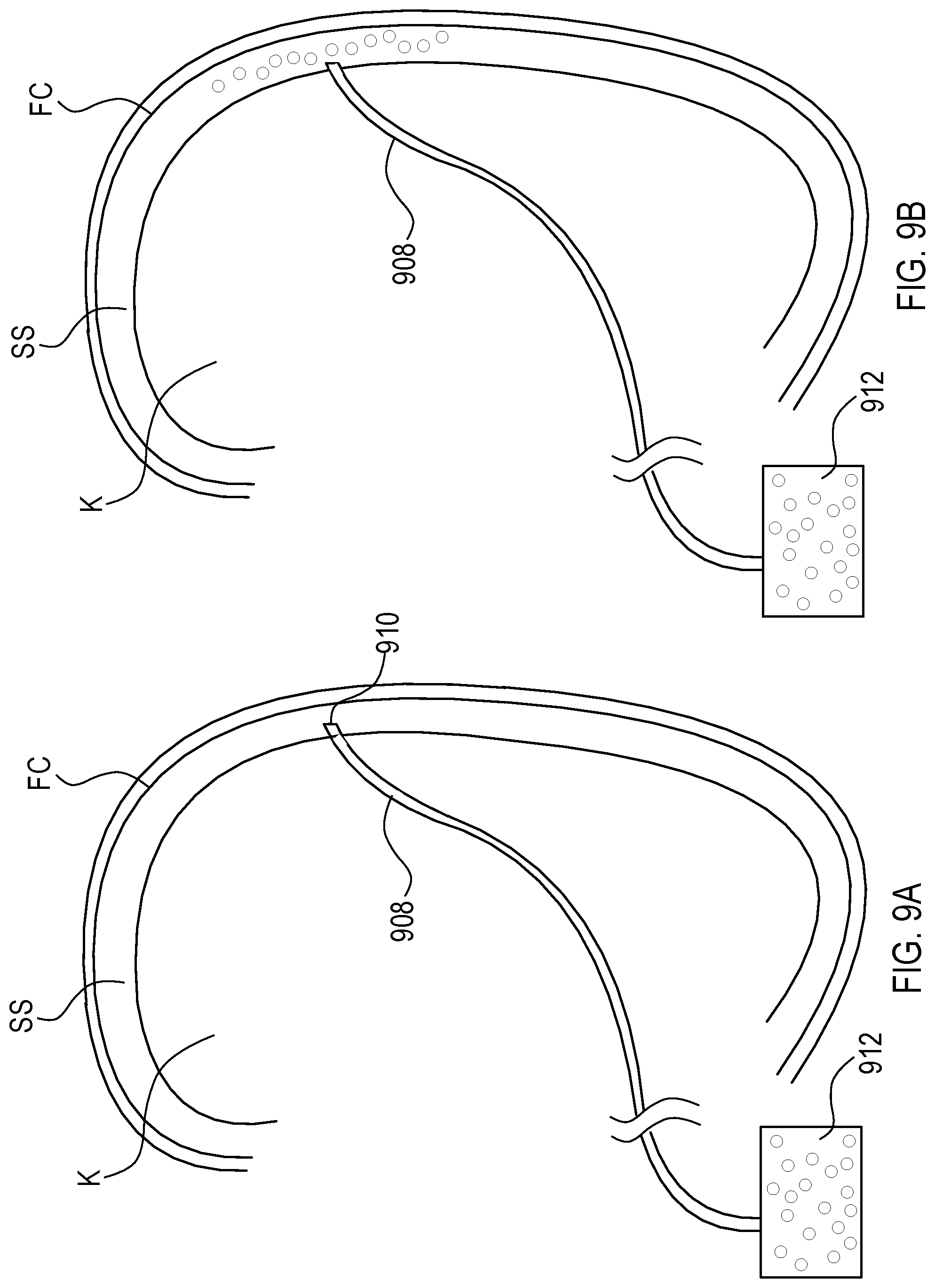 Patent US12564423 Figure 15 – Systems and methods for accessing a renal capsule for diagnostic and therapeutic purposes