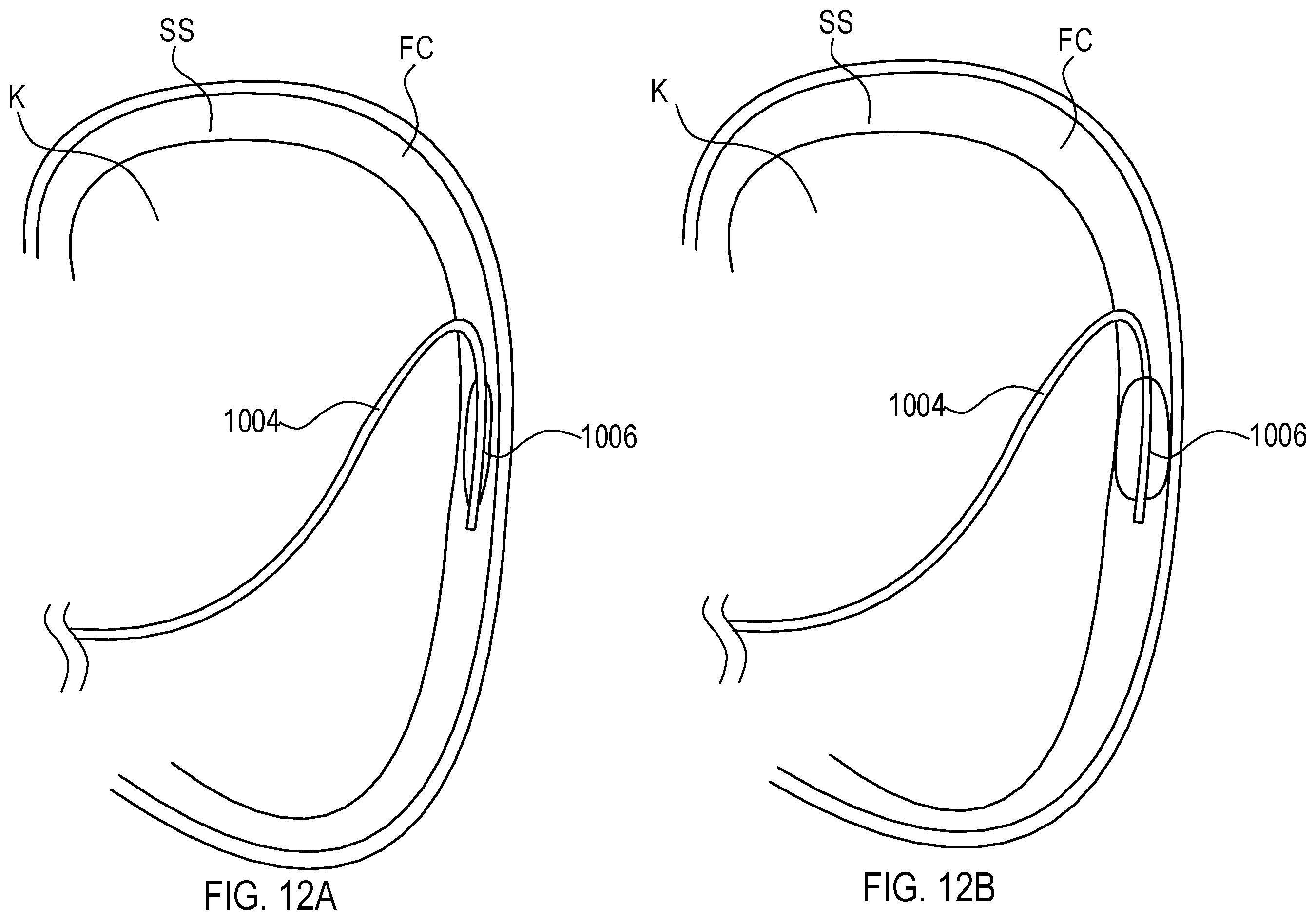 Patent US12564423 Figure 18 – Systems and methods for accessing a renal capsule for diagnostic and therapeutic purposes