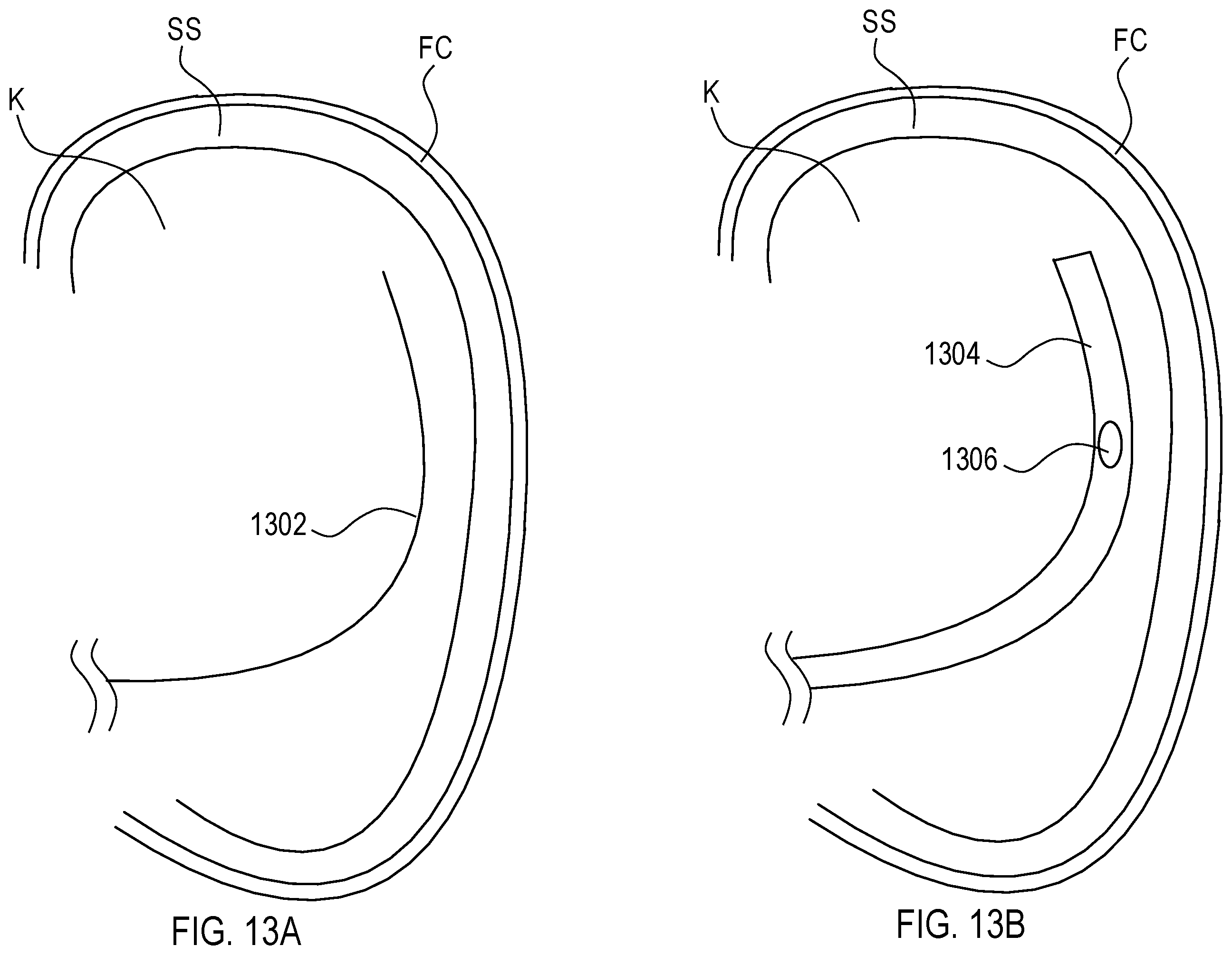 Patent US12564423 Figure 20 – Systems and methods for accessing a renal capsule for diagnostic and therapeutic purposes