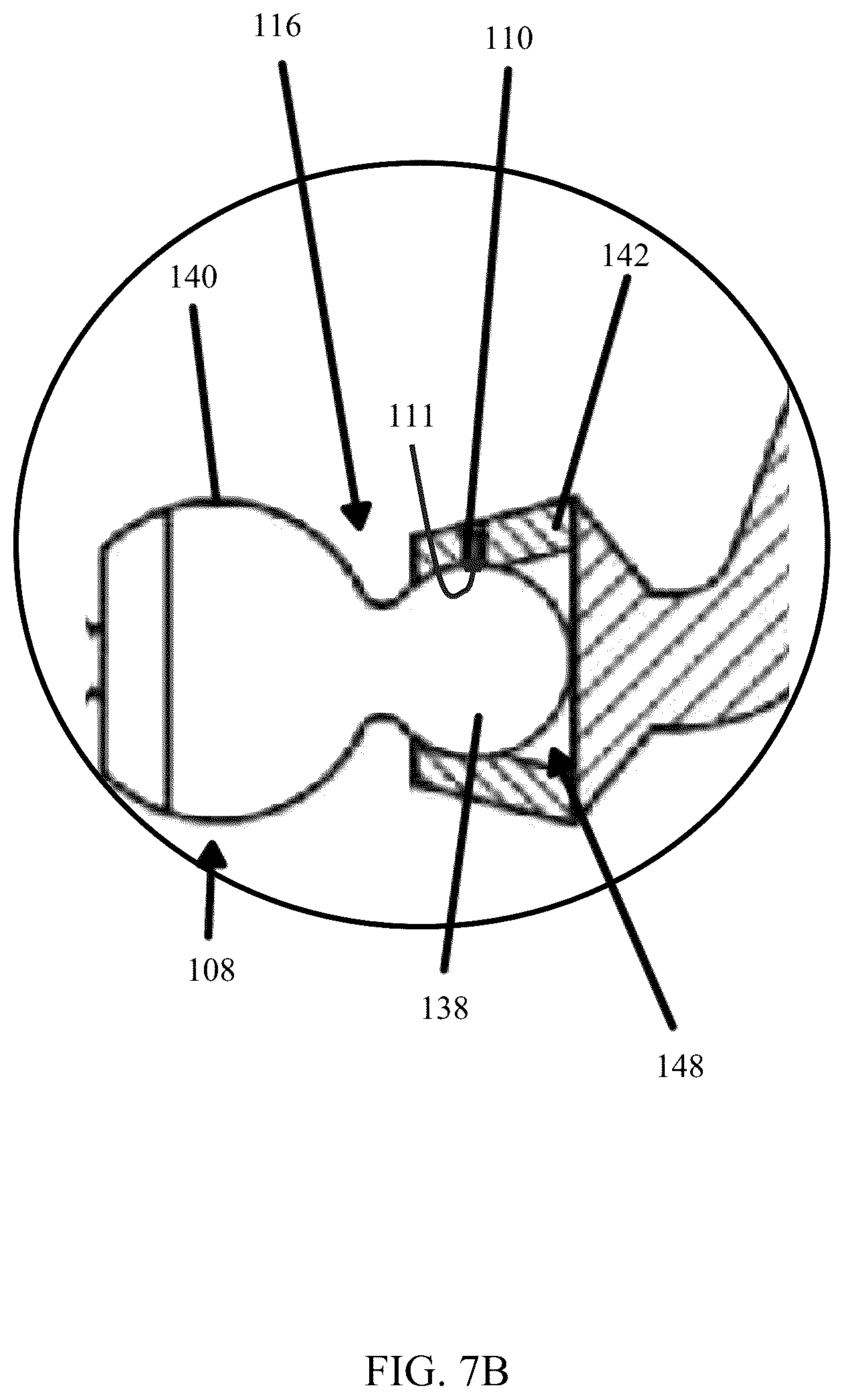 Patent US12564425 Figure 4 – Articulating spinal rod system