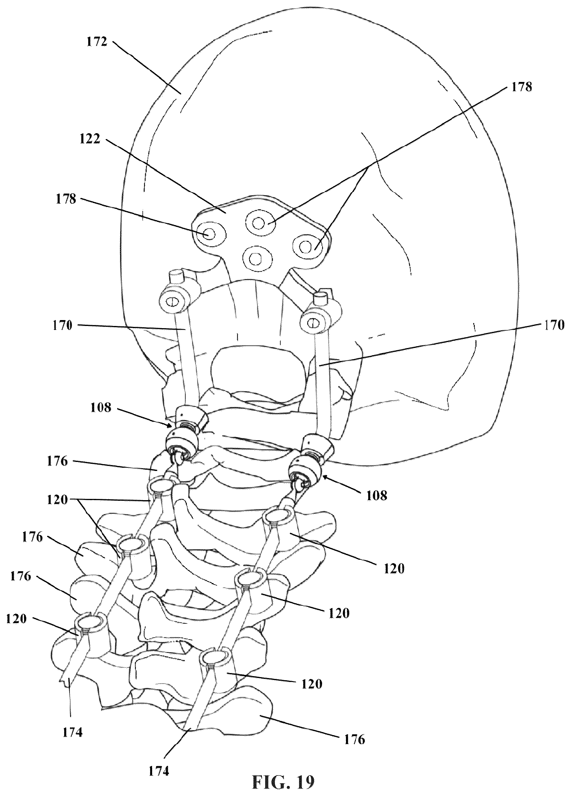 Patent US12564425 Figure 9 – Articulating spinal rod system