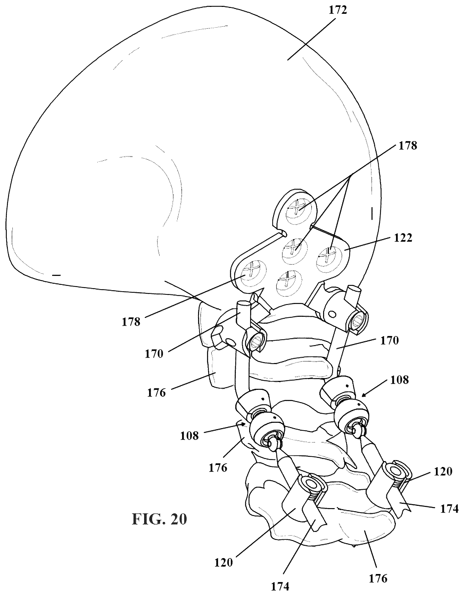 Patent US12564425 Figure 10 – Articulating spinal rod system