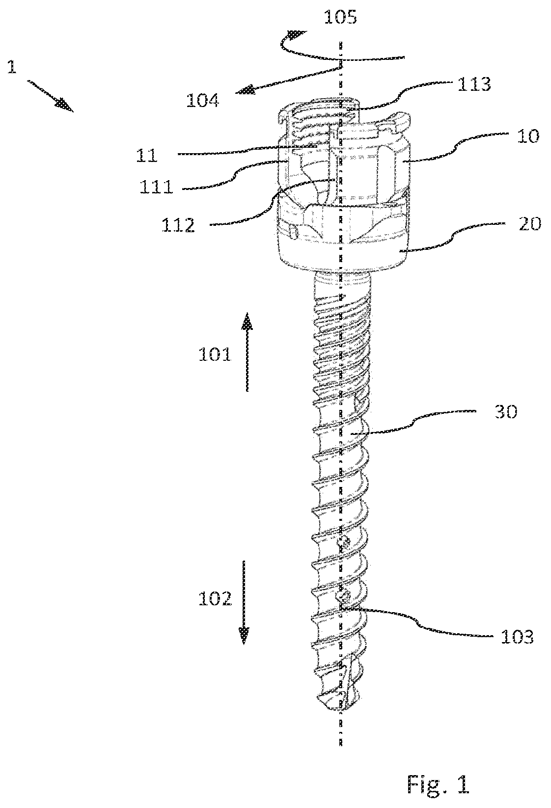 Patent US12564426 Figure 1 – Modular and temporarily fixable osteosynthesis device for vertebrae