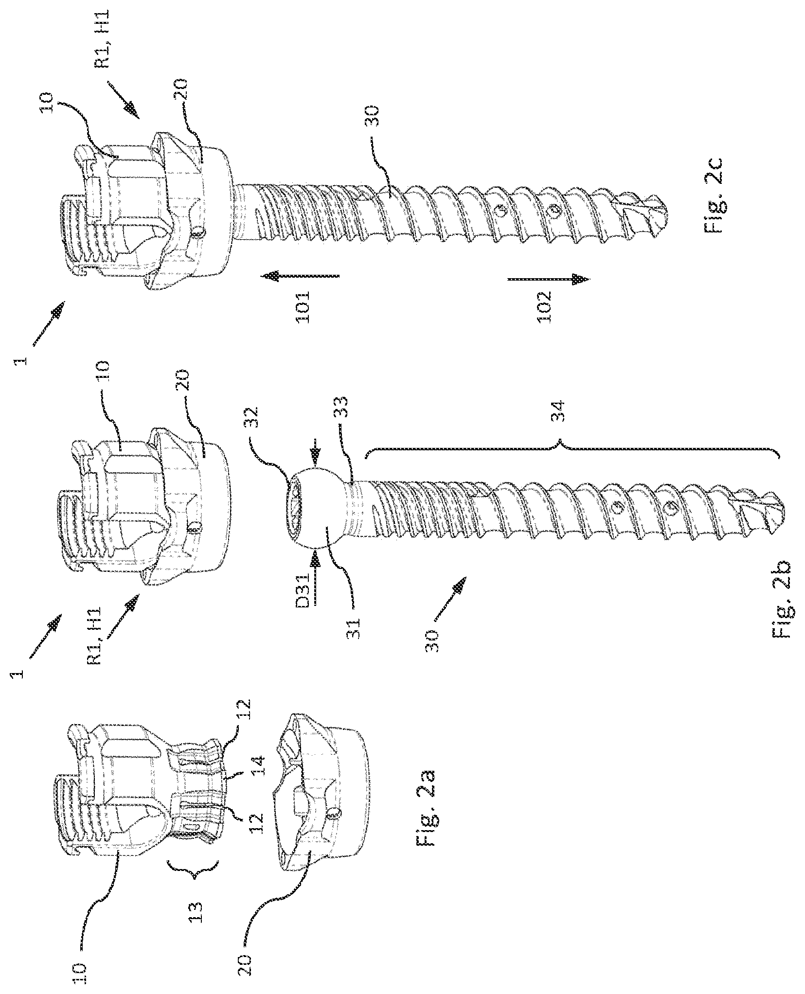 Patent US12564426 Figure 2 – Modular and temporarily fixable osteosynthesis device for vertebrae