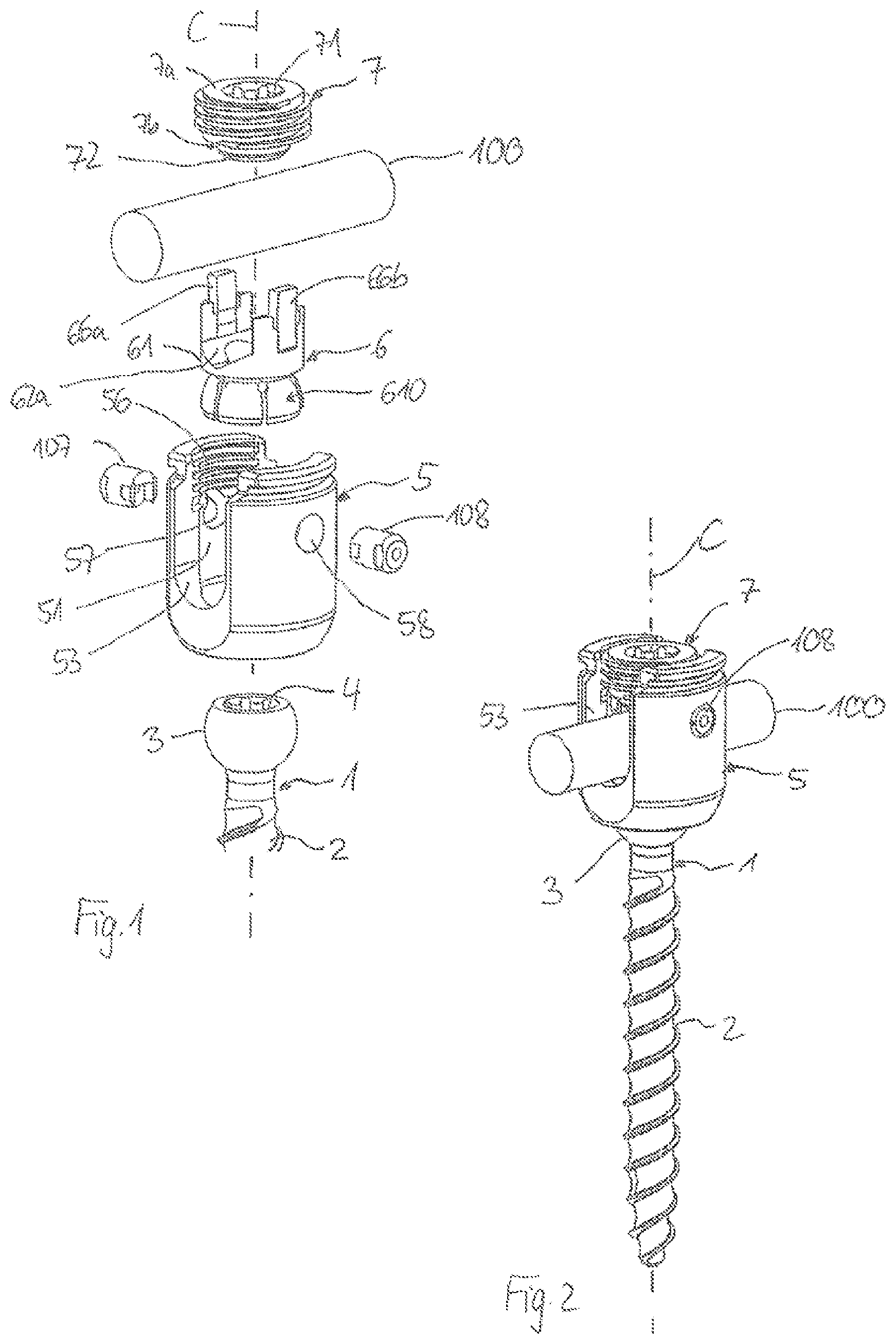 Patent US12564427 Figure 1 – Polyaxial bone anchoring device