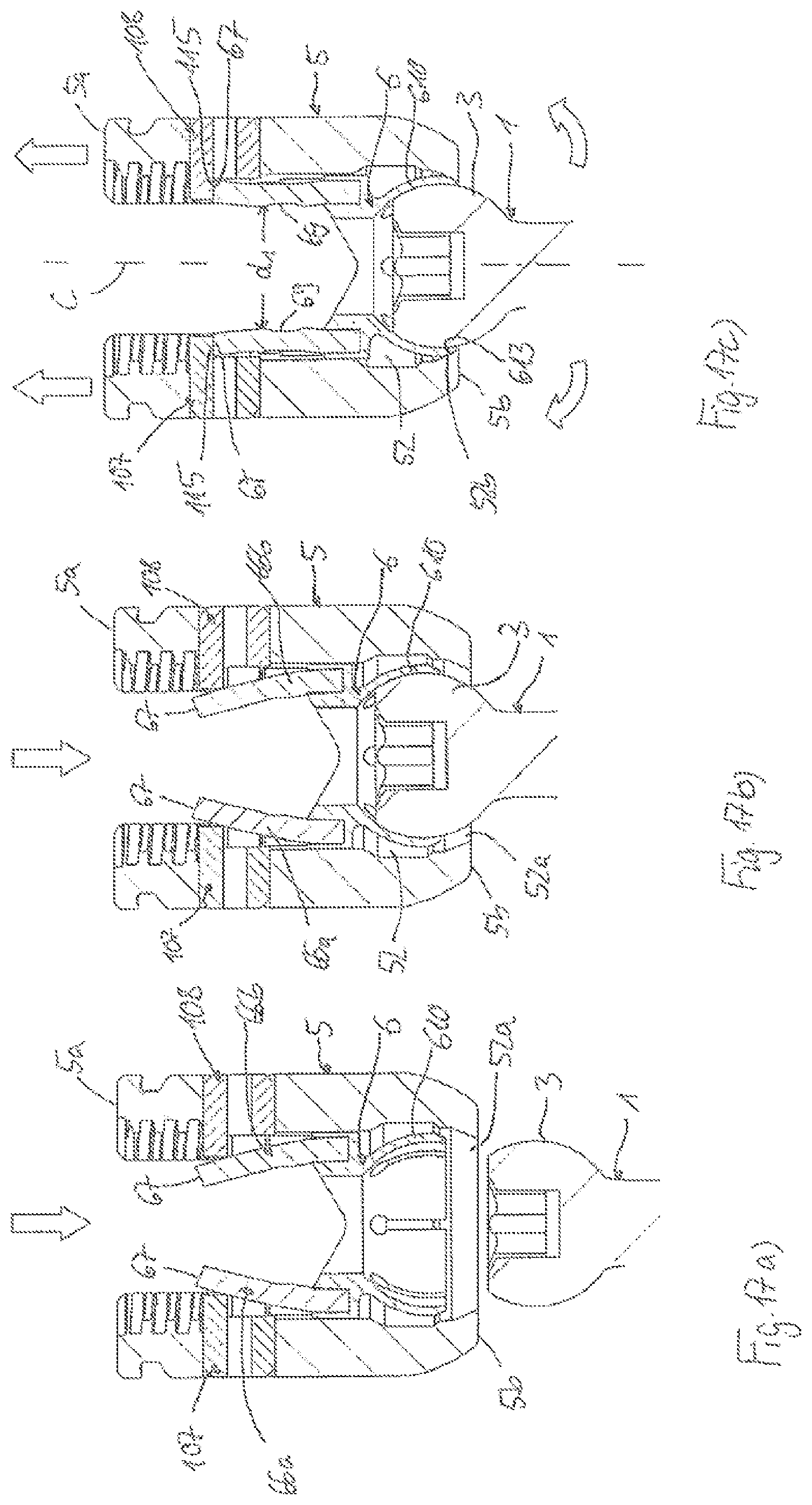 Patent US12564427 Figure 6 – Polyaxial bone anchoring device