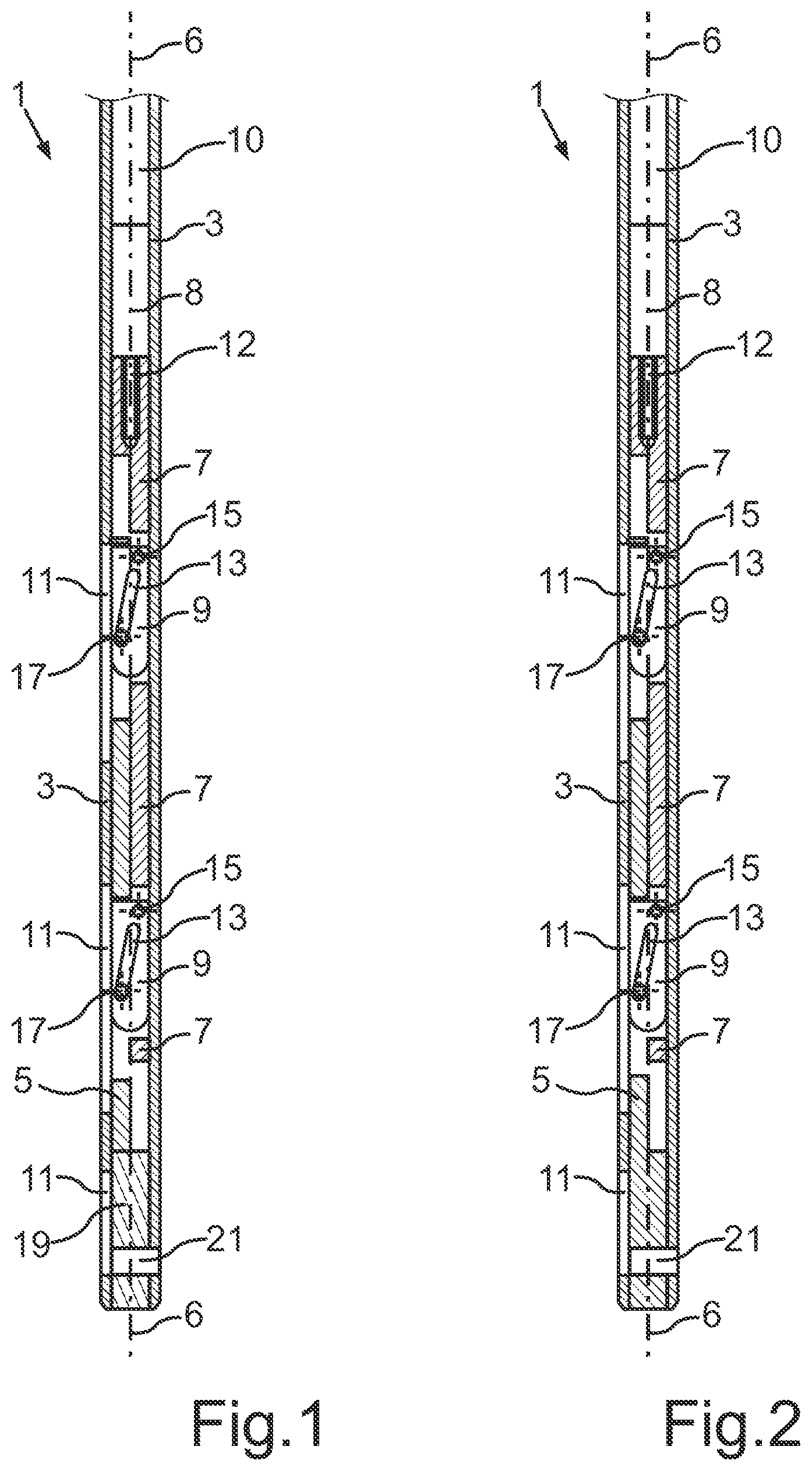 Patent US12564428 Figure 1 – Intramedullary nail for transverse distraction
