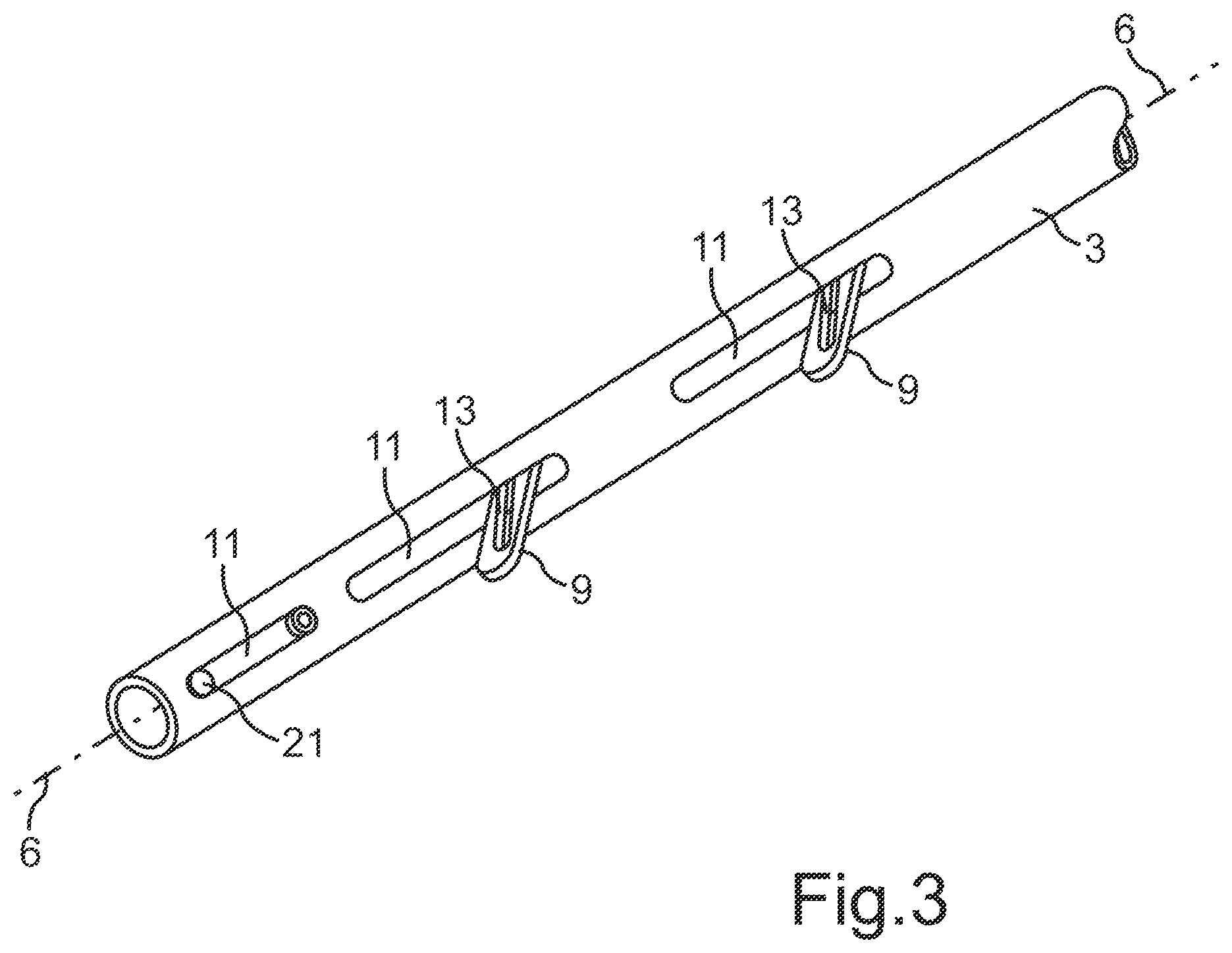 Patent US12564428 Figure 2 – Intramedullary nail for transverse distraction