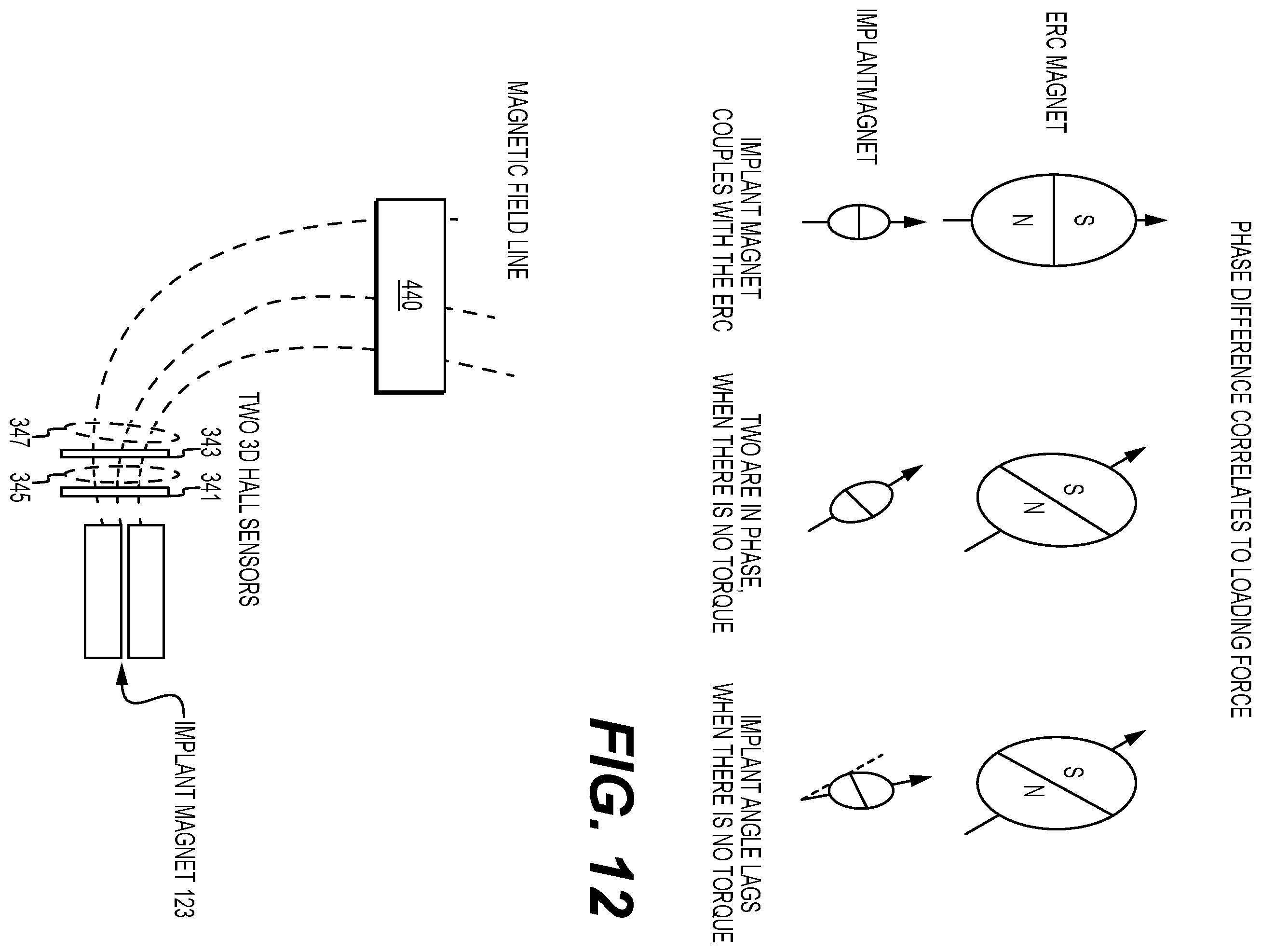 Patent US12564429 Figure 7 – Adjustable implant, system and methods