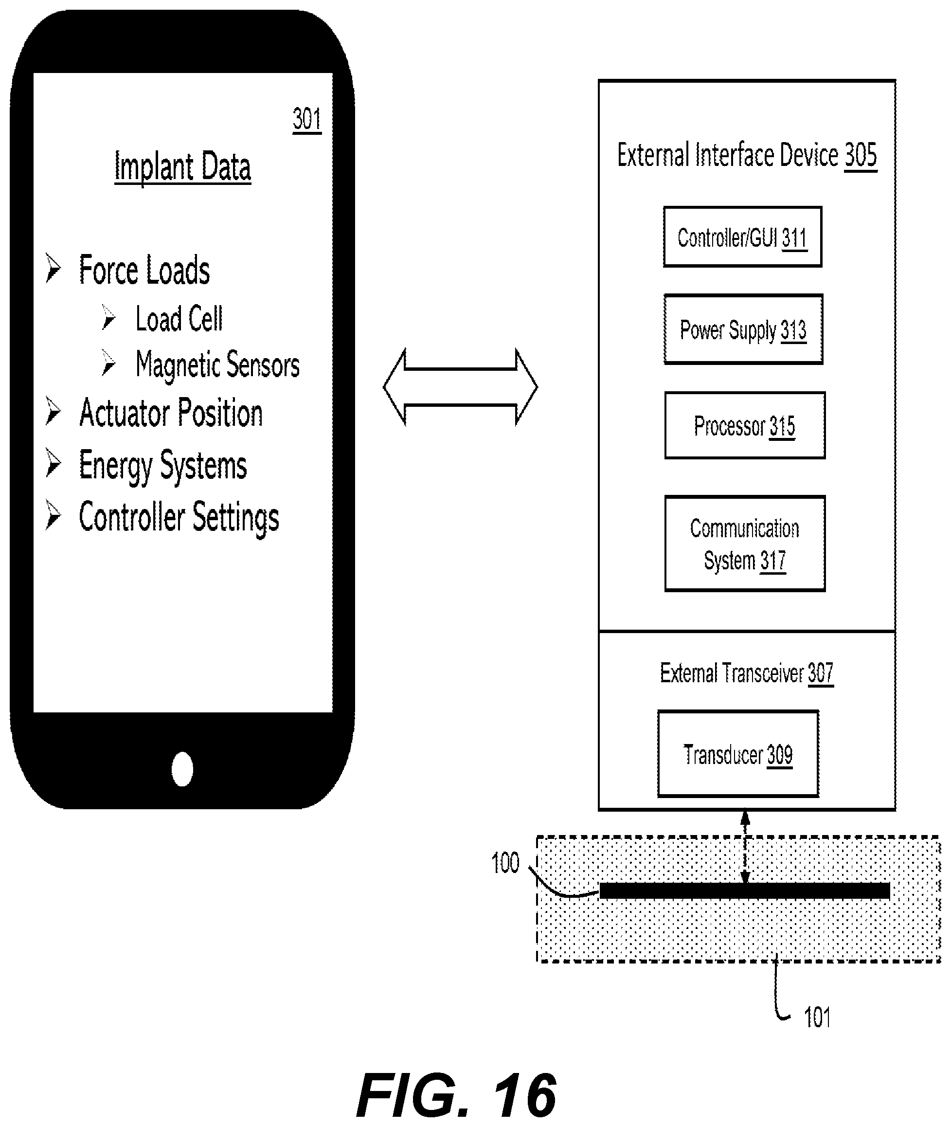 Patent US12564429 Figure 10 – Adjustable implant, system and methods