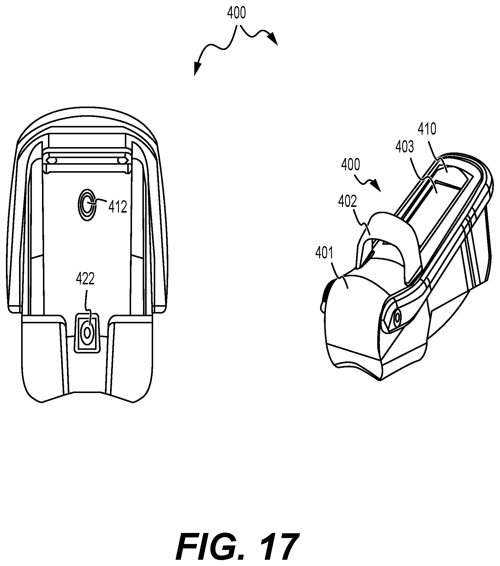 Patent US12564429 Figure 11 – Adjustable implant, system and methods