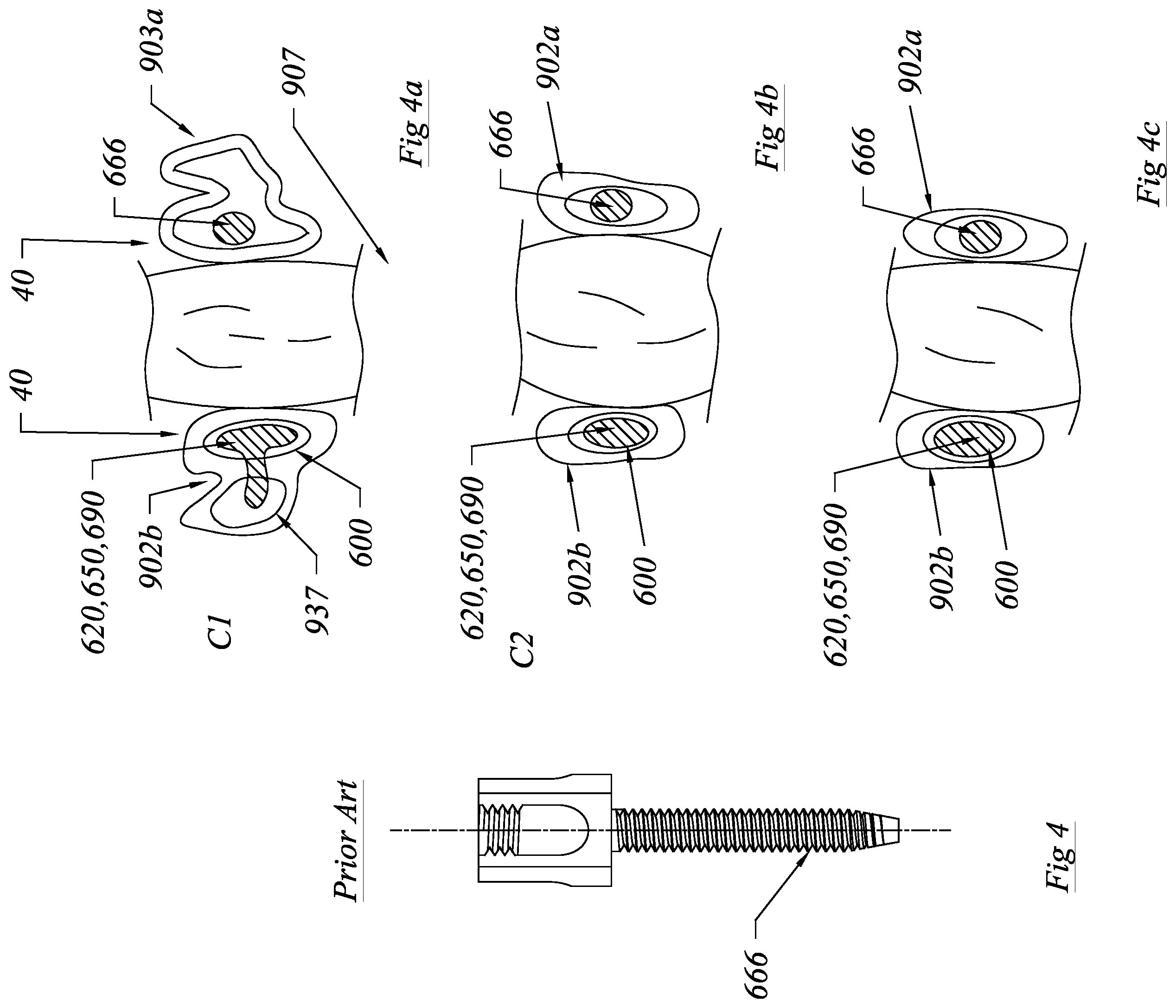 Patent US12564430 Figure 4 – Computerized process for making a patient-specific implant