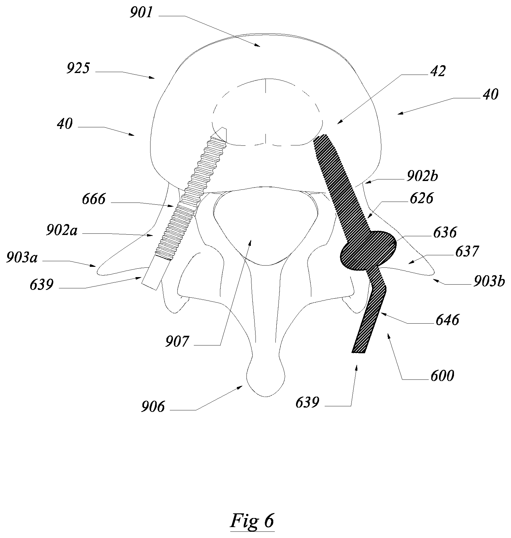 Patent US12564430 Figure 6 – Computerized process for making a patient-specific implant
