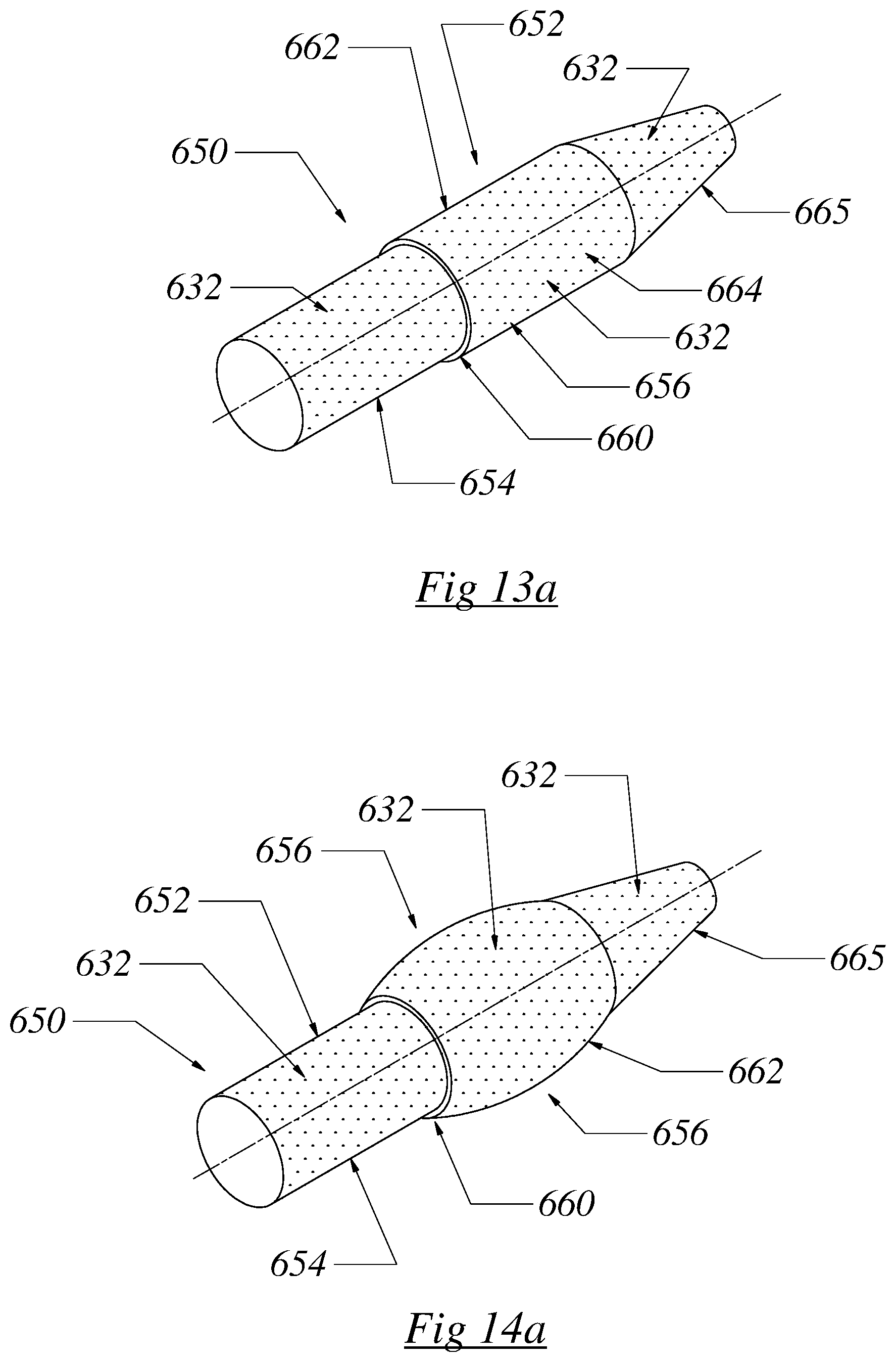 Patent US12564430 Figure 14 – Computerized process for making a patient-specific implant
