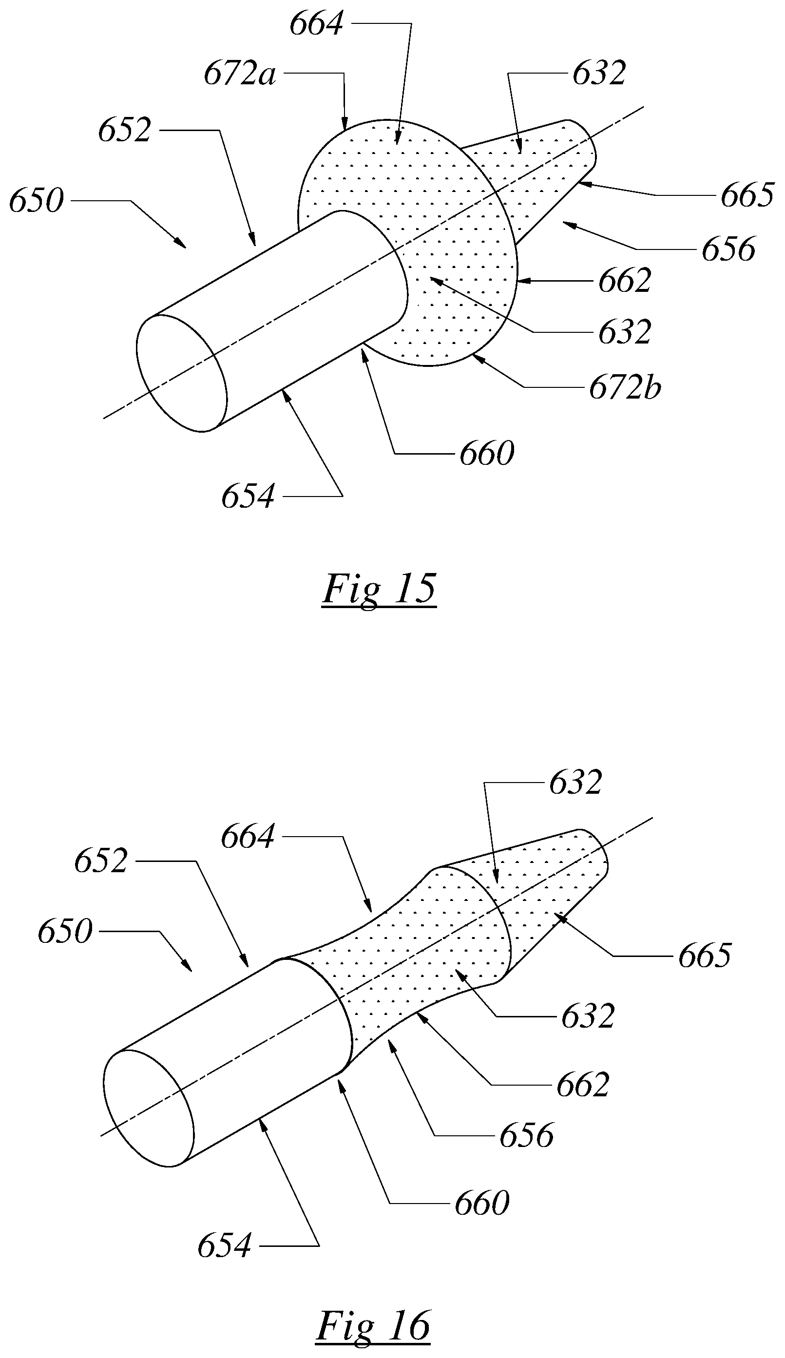 Patent US12564430 Figure 15 – Computerized process for making a patient-specific implant