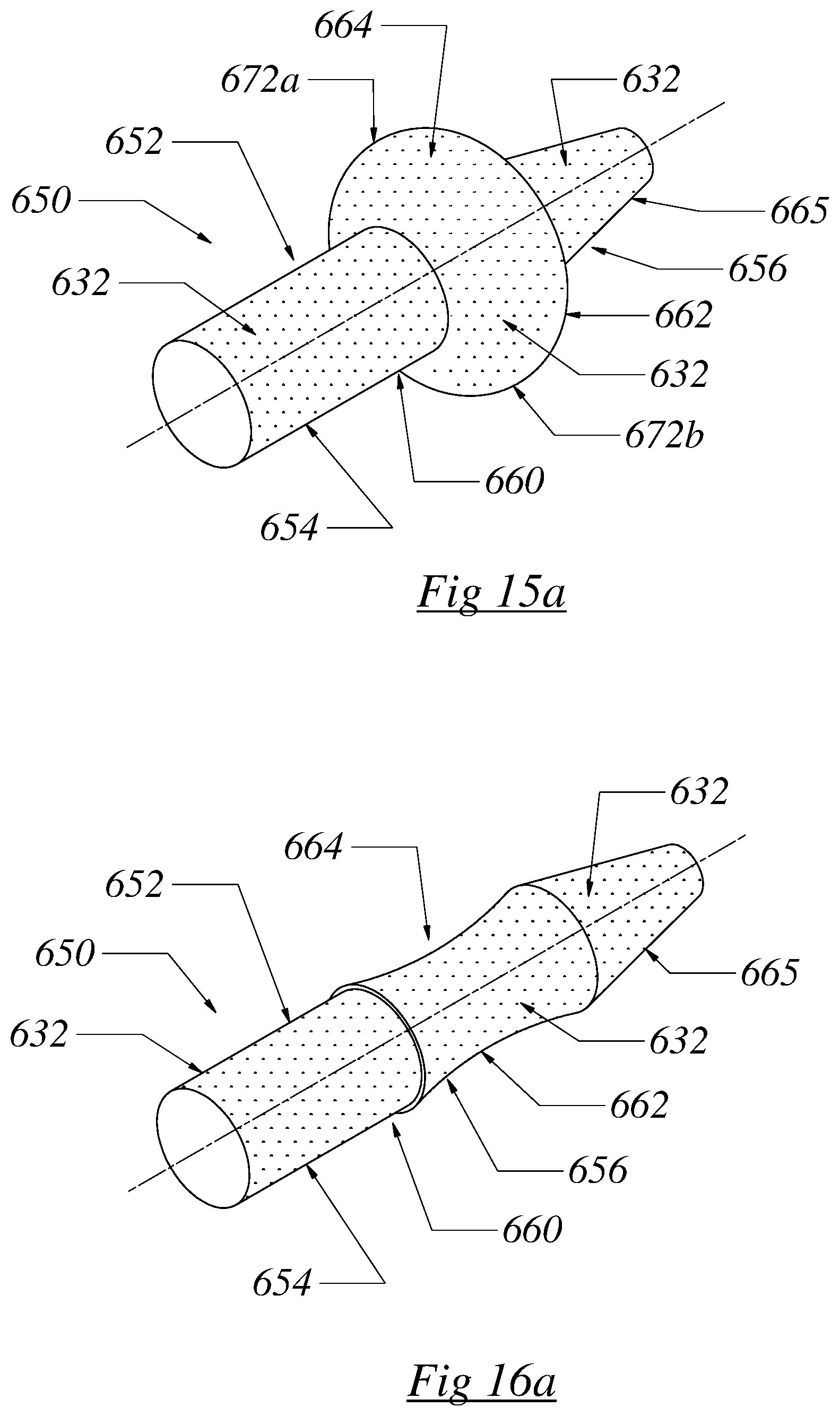 Patent US12564430 Figure 16 – Computerized process for making a patient-specific implant